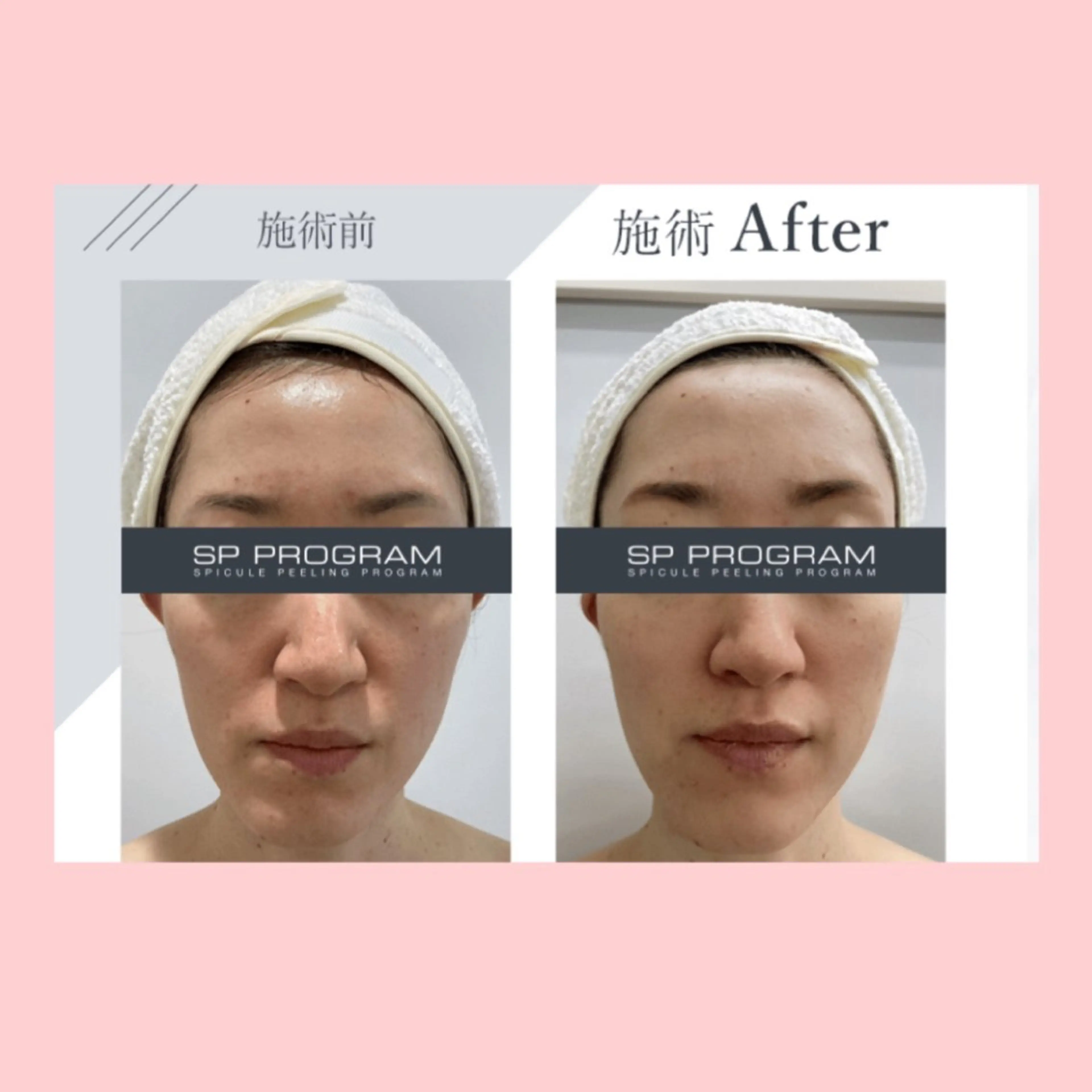 その他 Palum Airiのエステ・リラクイメージ