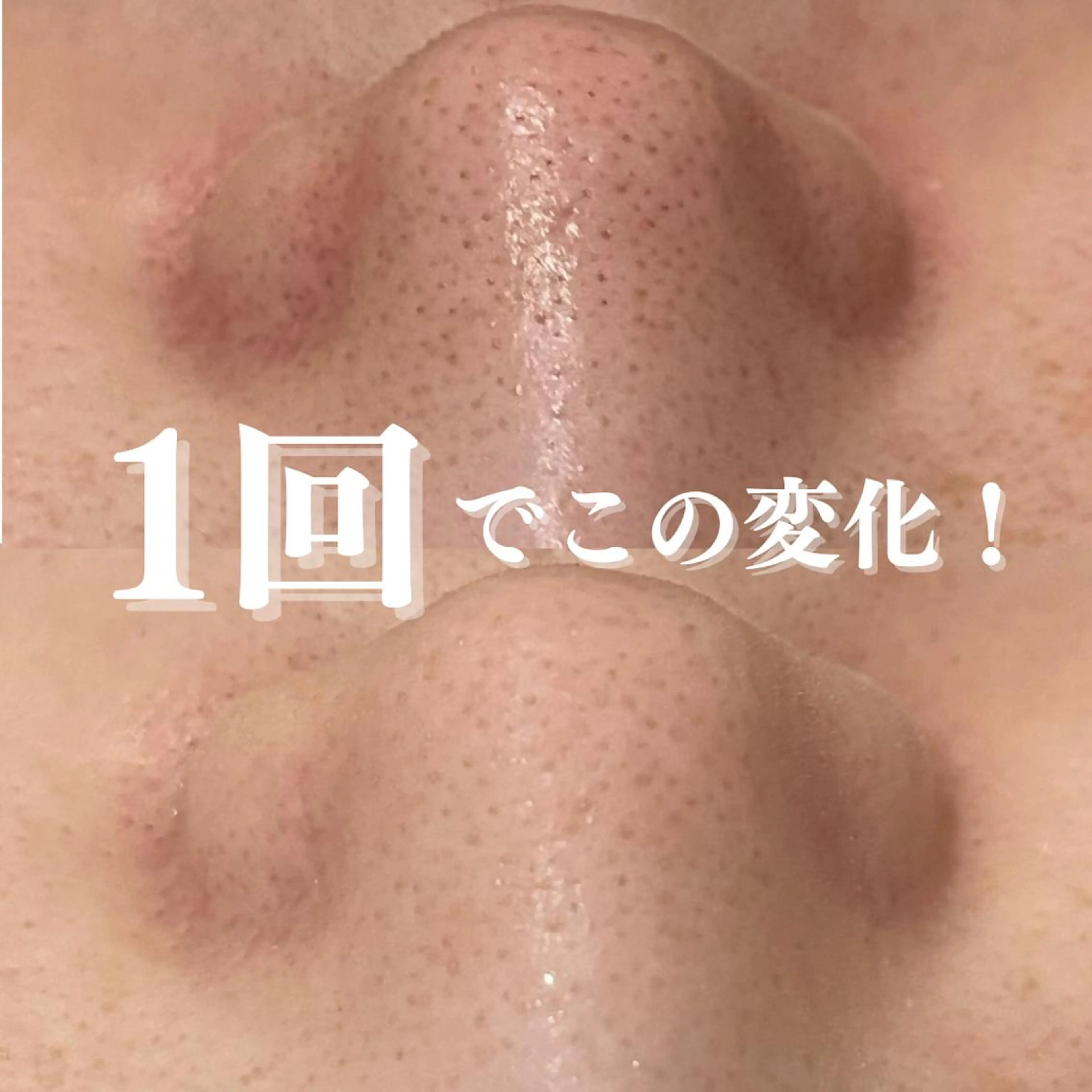 ダウンタイムなし✨ 敏感肌さん用エステのエステ・リラクイメージ