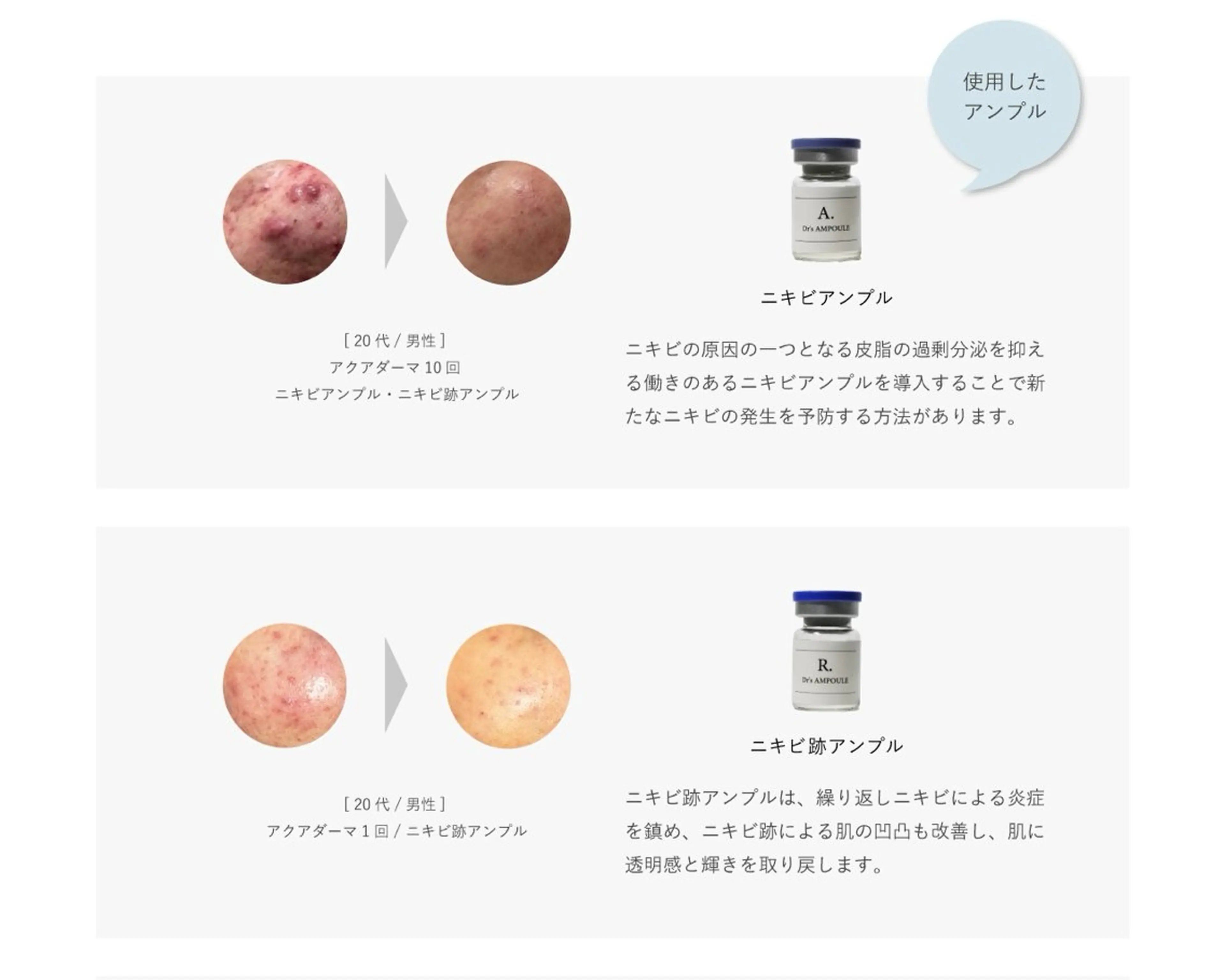 エステ 💐美肌/小顔づくり 🫧看護師🫧ASAのエステ・リラクイメージ