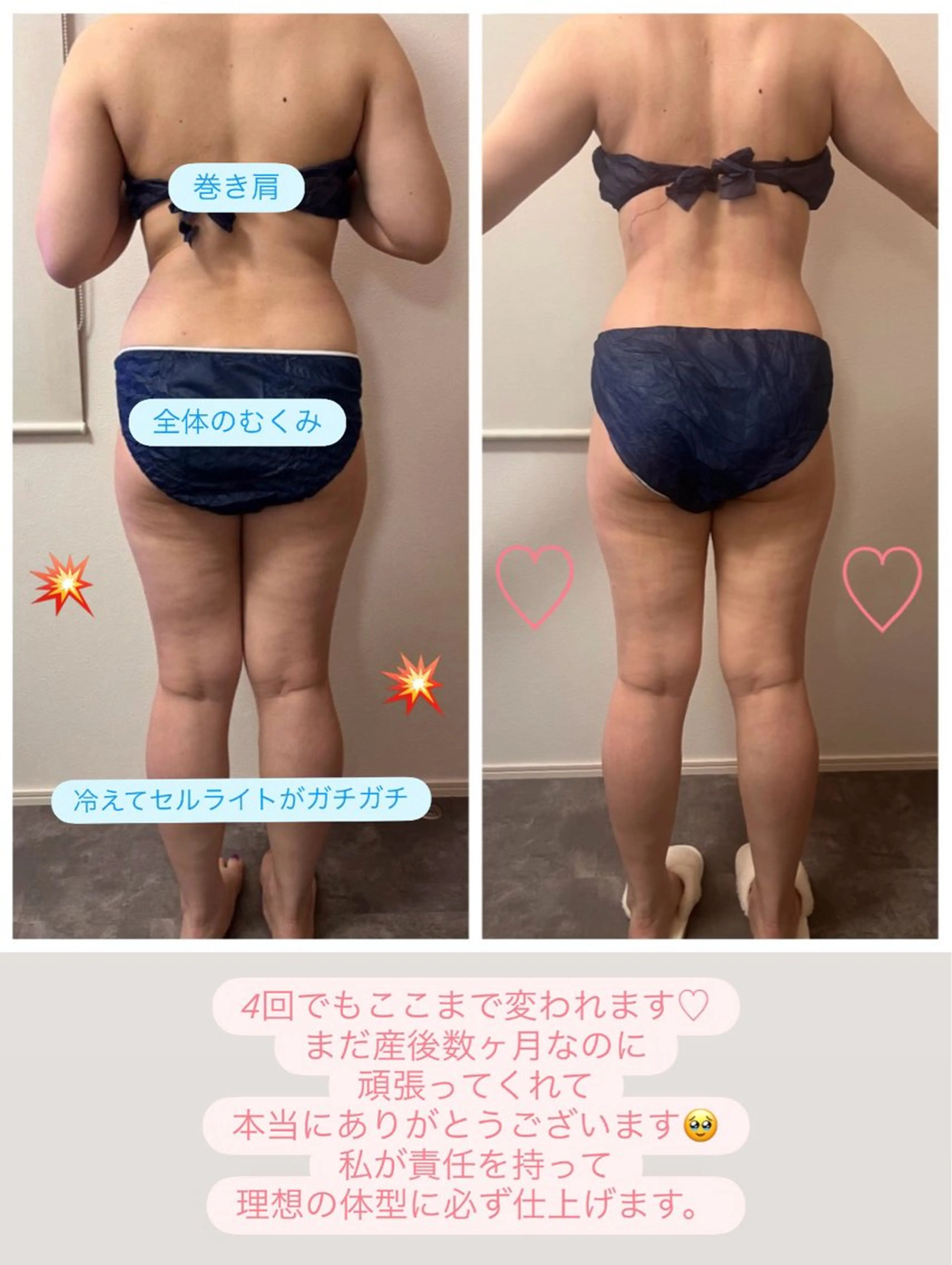 エステ 本気で痩せたい方へ 痩身専門サロンのその他イメージ