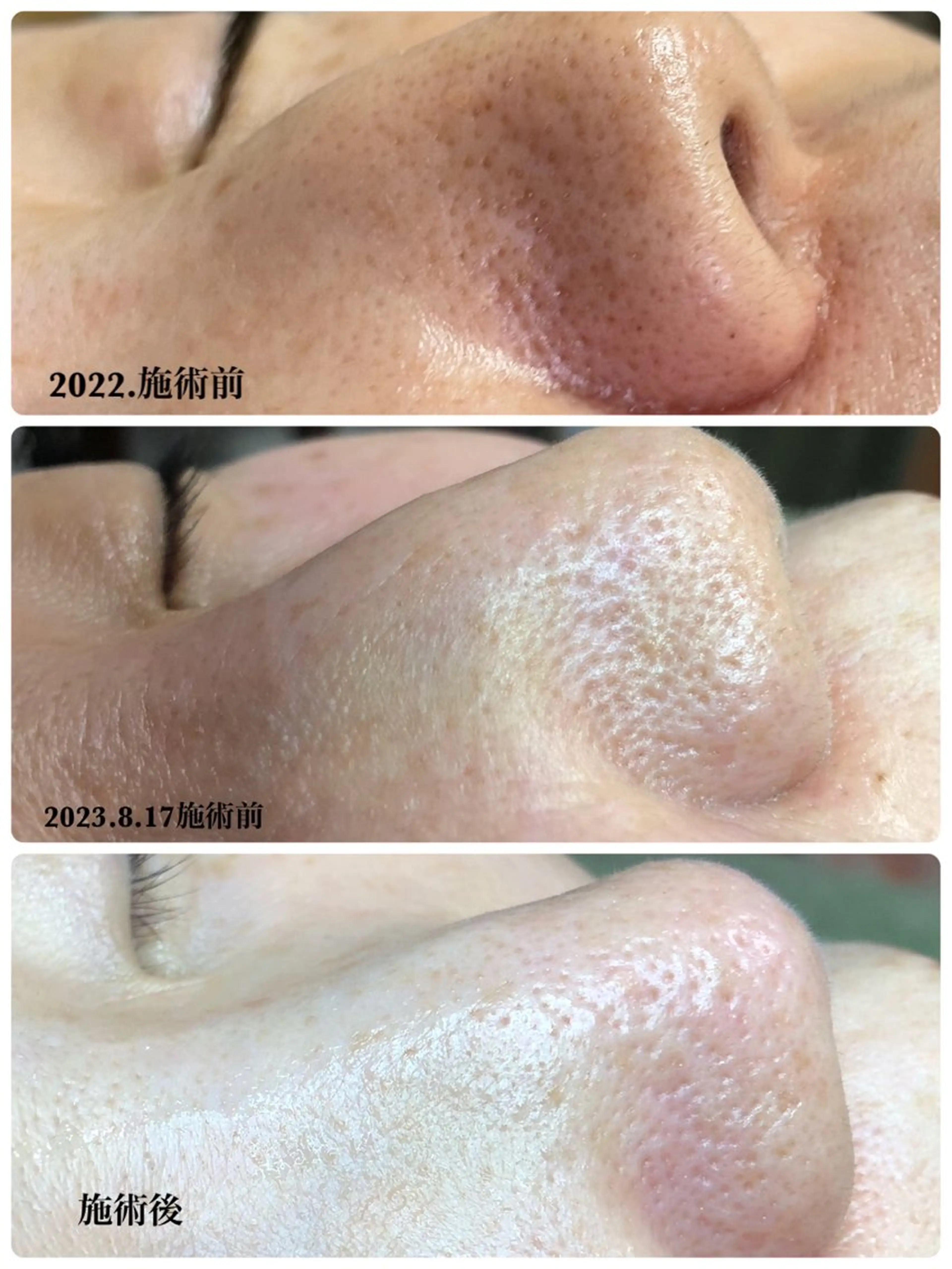 private salon Dea_maris シュガーリング&パーソナルボディケア所属・シミ改善・韓国肌管理 ボディメイク痩身のその他イメージ