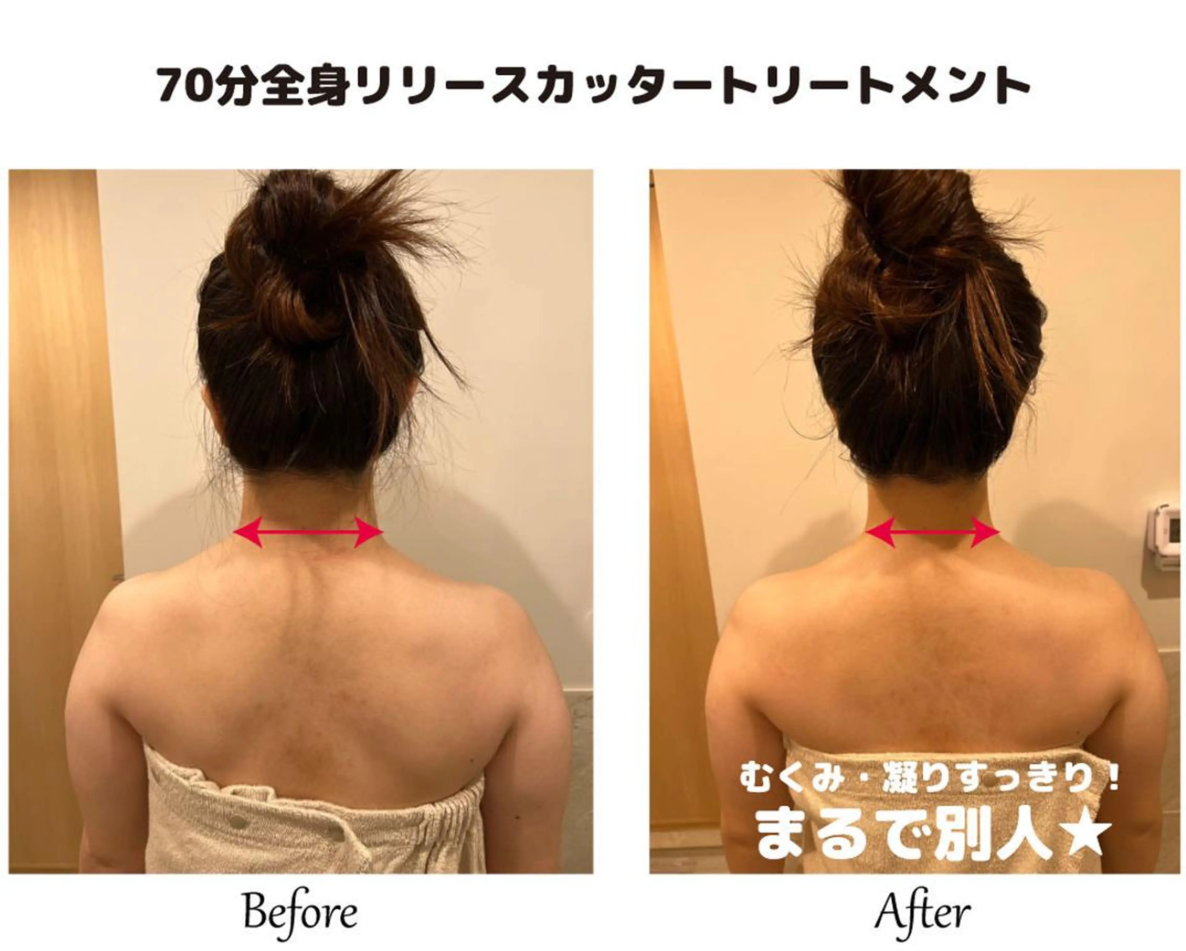 痩身×フェイシャル ブライダル|Linoのエステ・リラクイメージ