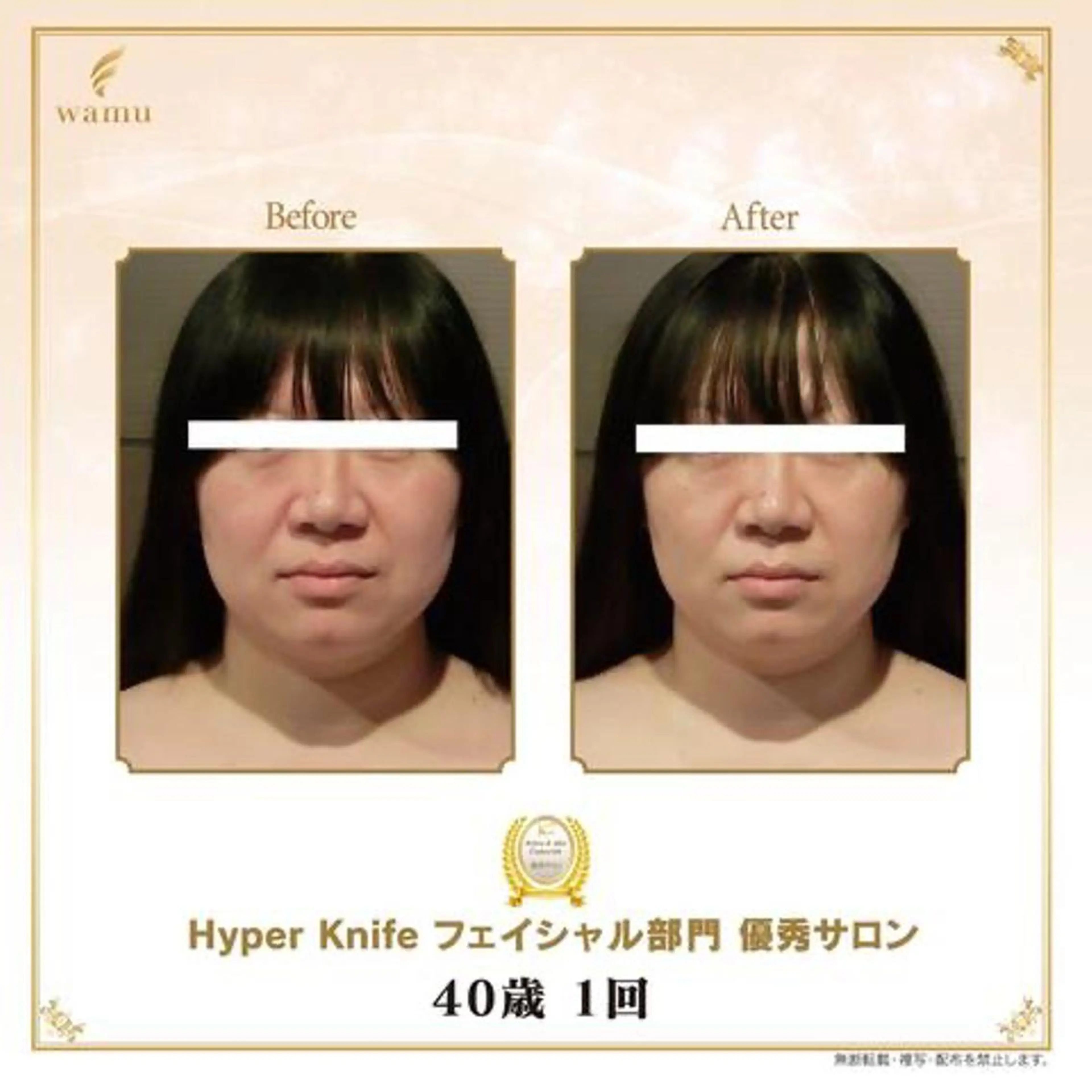 アロマクイーン所属・所沢痩身小顔コルギ AromaQueenのエステ・リラクイメージ