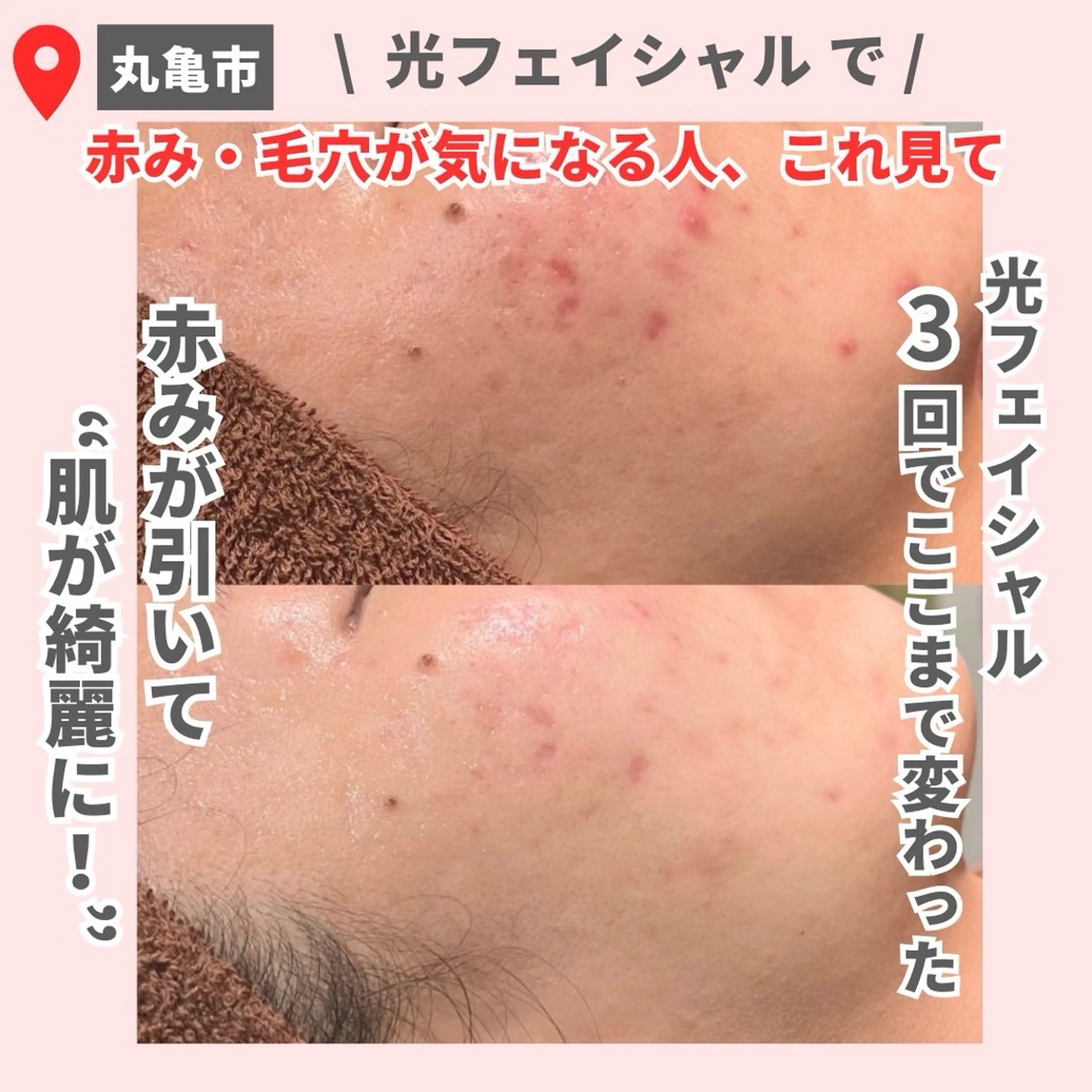 前山 くるみのエステ・リラクイメージ