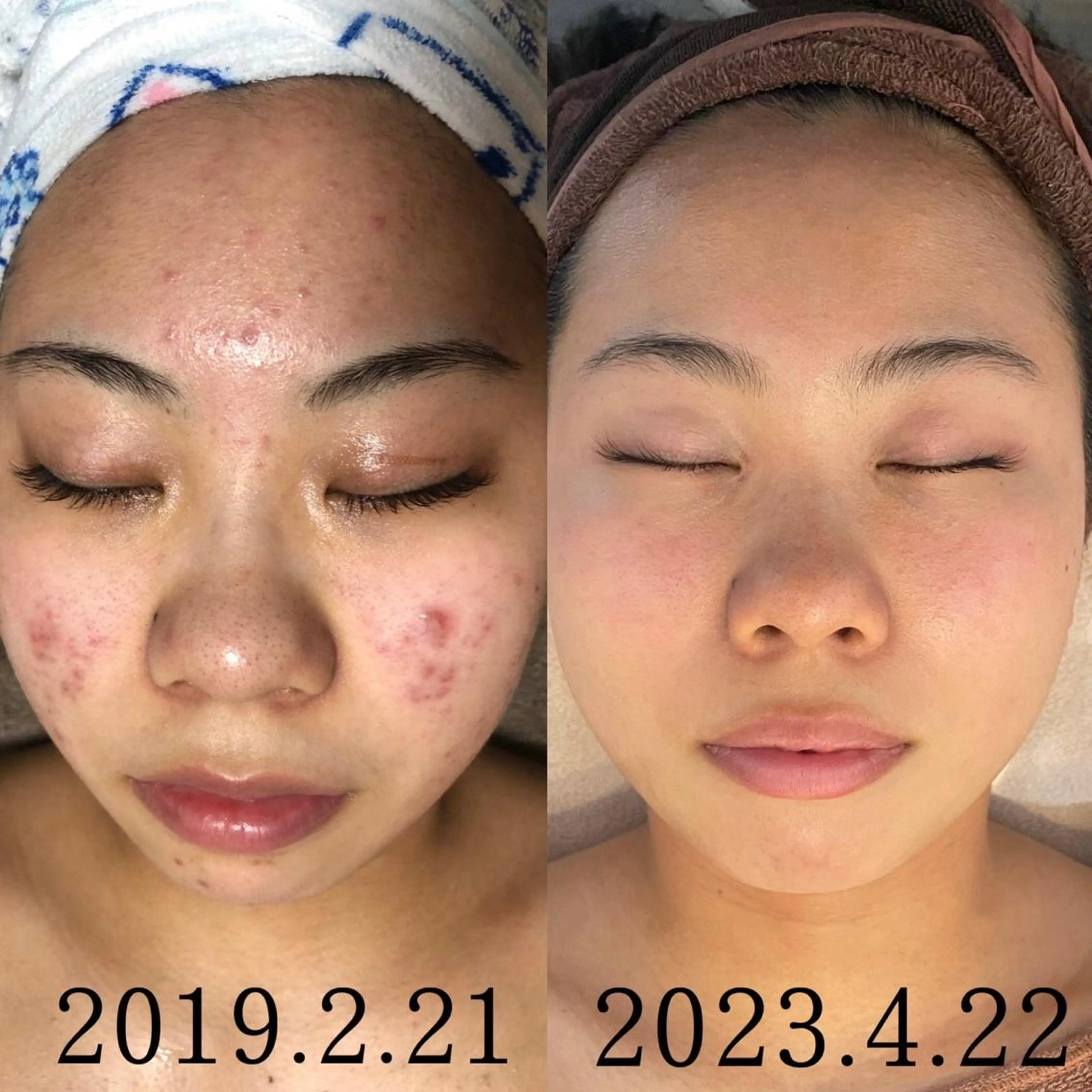 private salon Dea_maris シュガーリング&パーソナルボディケア所属・シミ改善・韓国肌管理 ボディメイク痩身のその他イメージ