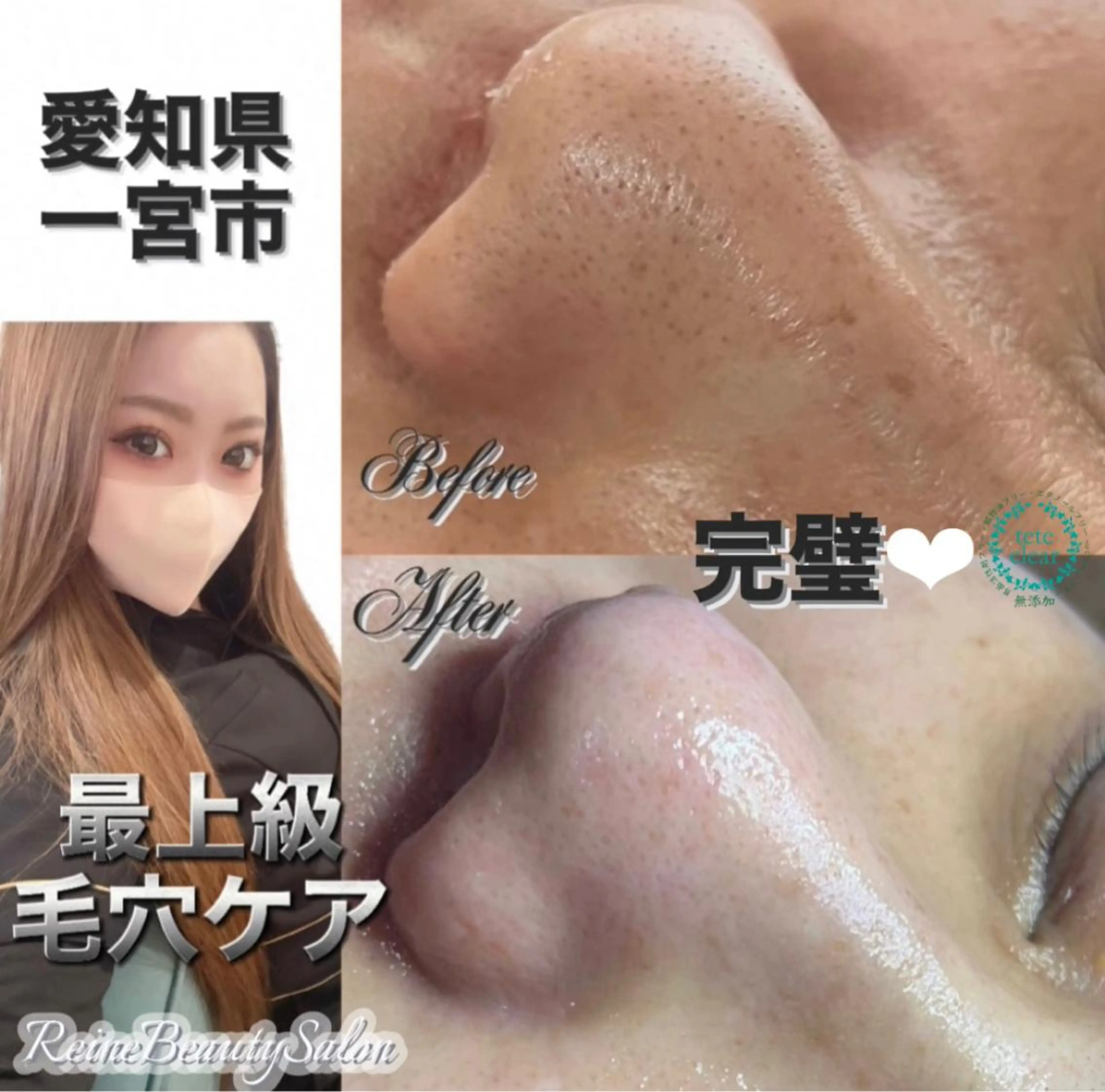 エステ Reine BeautySalon所属・毛穴/シミ肝斑/脱毛 横山梨里のエステ・リラクイメージ