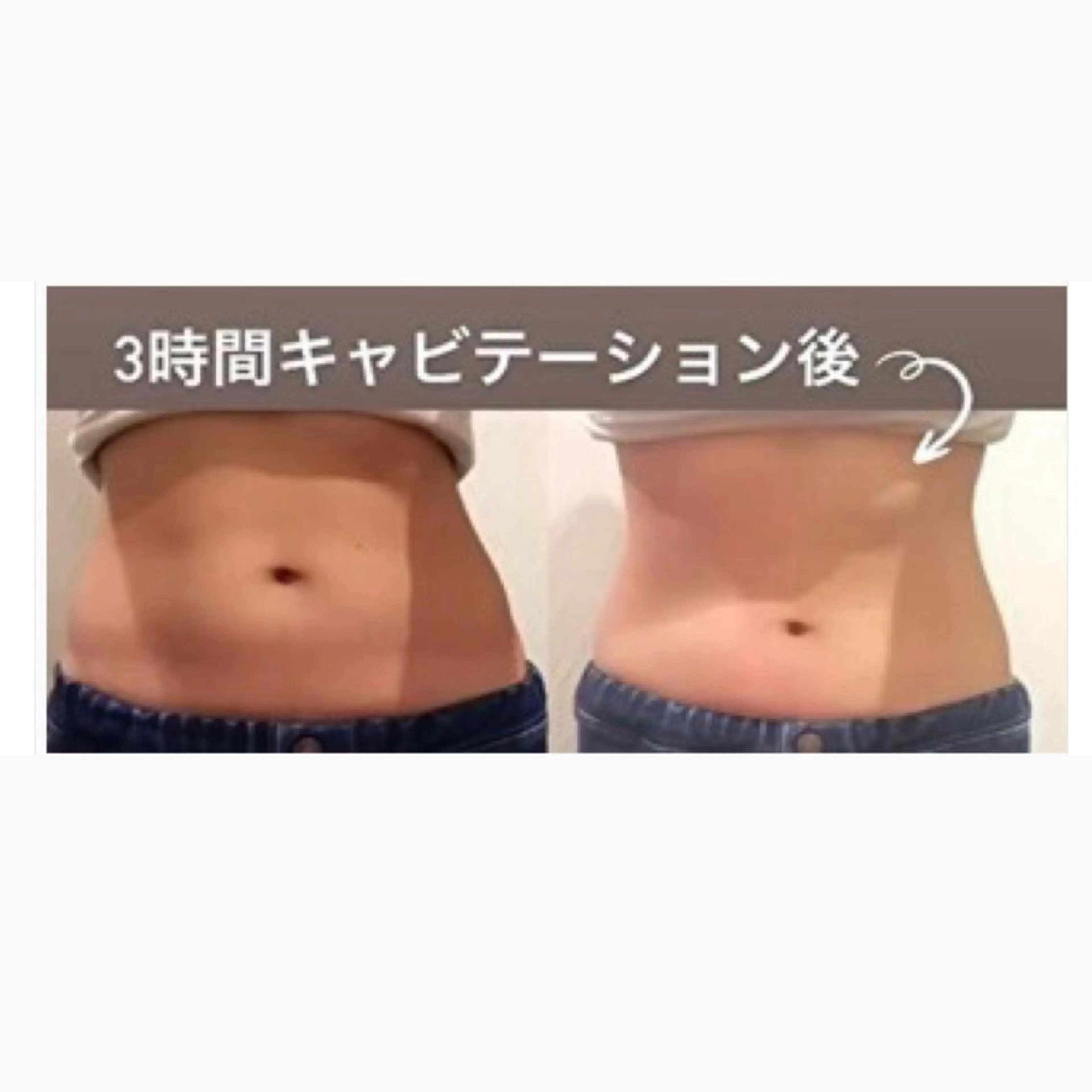 韓国クリニックの業務用マシン当て放題のセルフ(自分であてる)コース。痩身歴13年のベテランから直接指導してもらえます。の写真