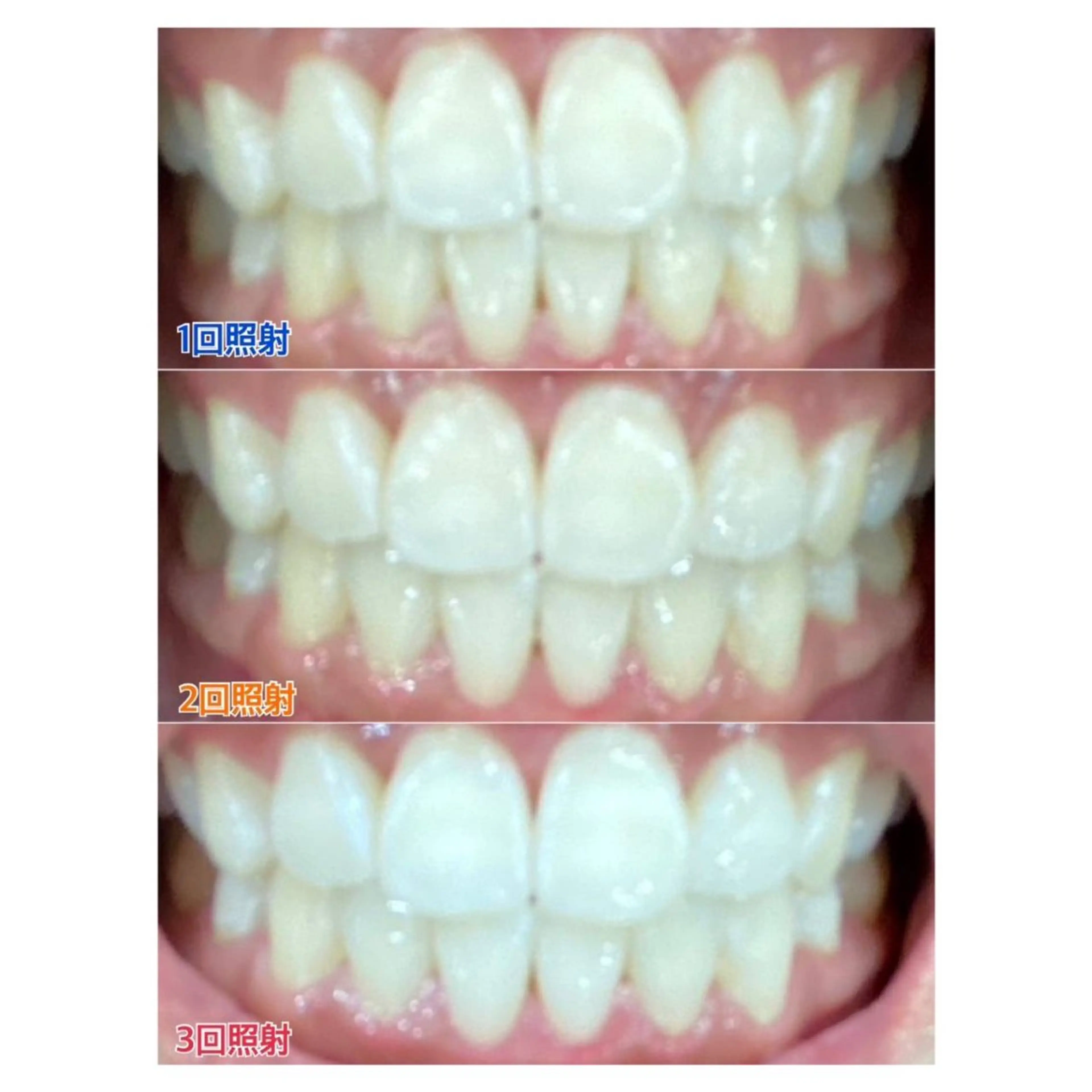 MBEAUTYSALON 千葉店・京成大久保所属・Melty 輝のその他イメージ