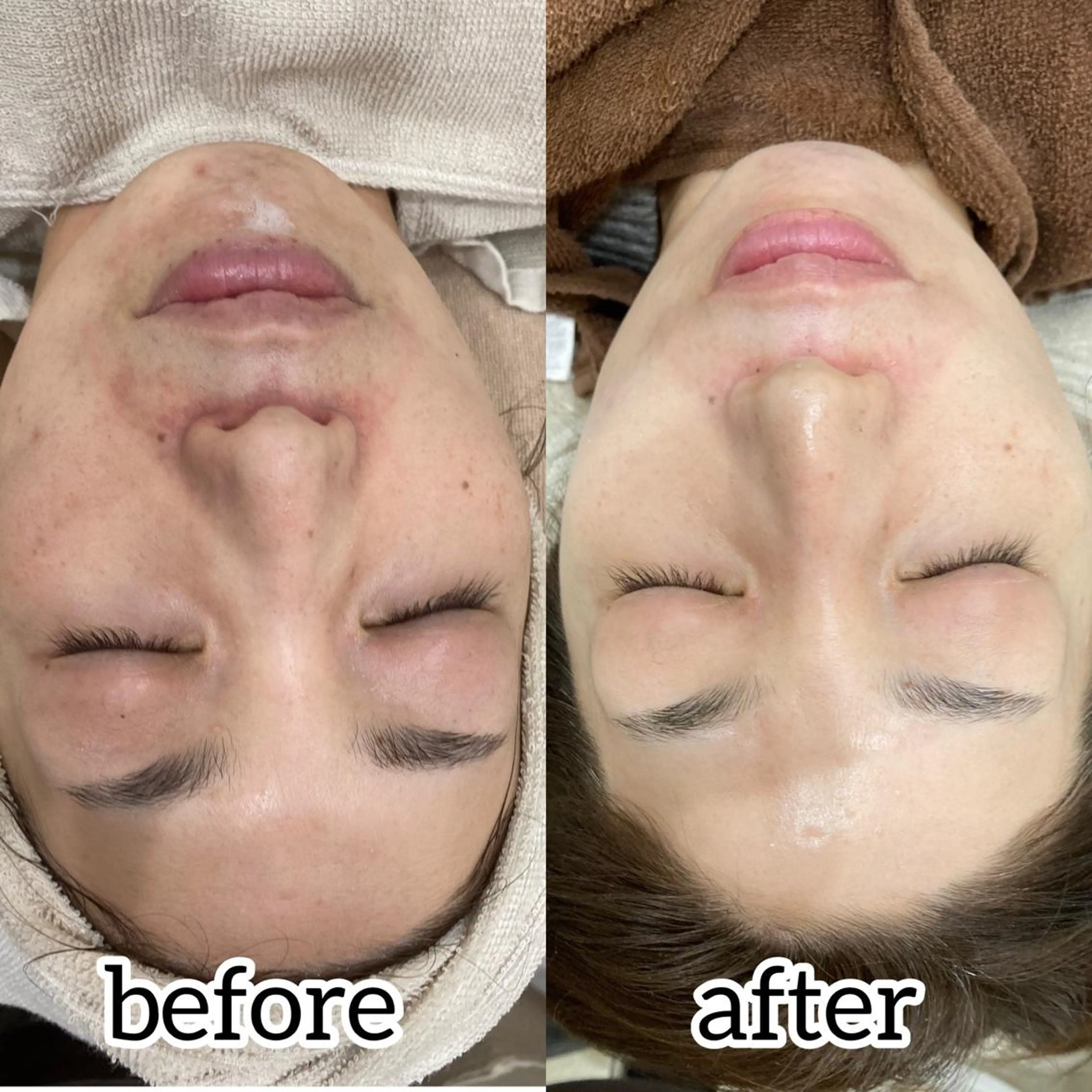 laluna saki...のその他イメージ