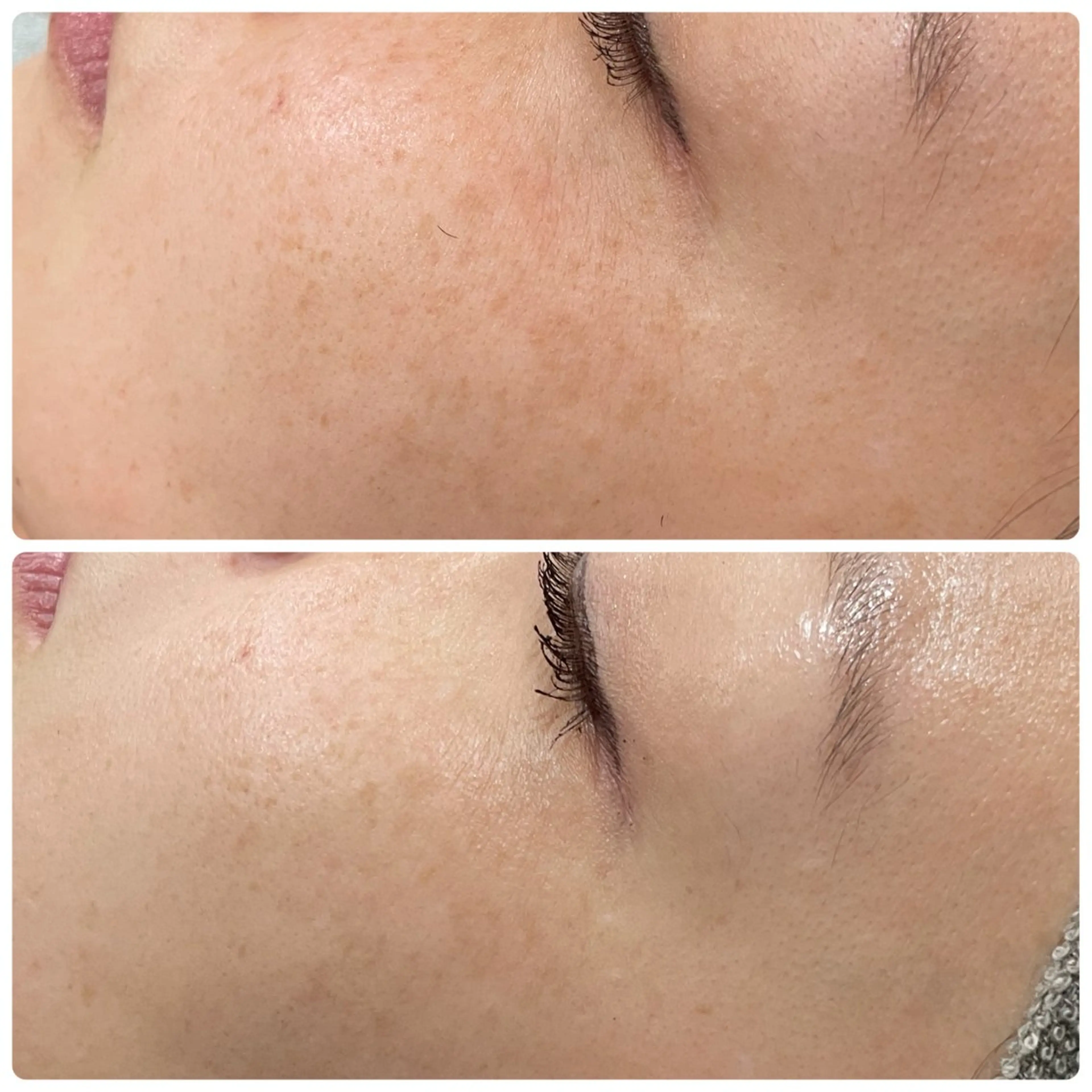 LiZA エステティックサロンのエステ・リラクイメージ