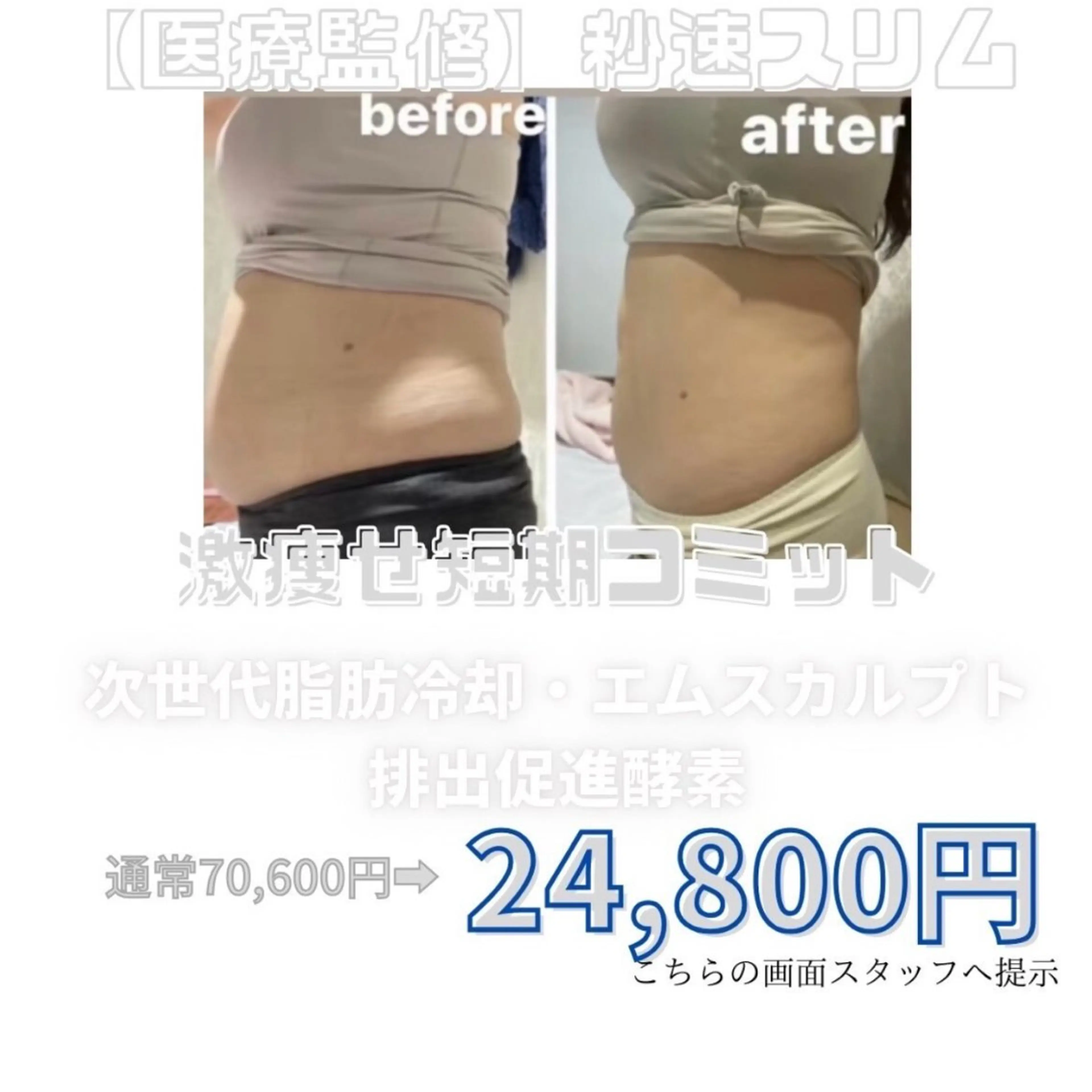 【デトックス痩身】 最高峰-12℃冷却痩身×高周波×次世代EMS×酵素ドリンクの写真