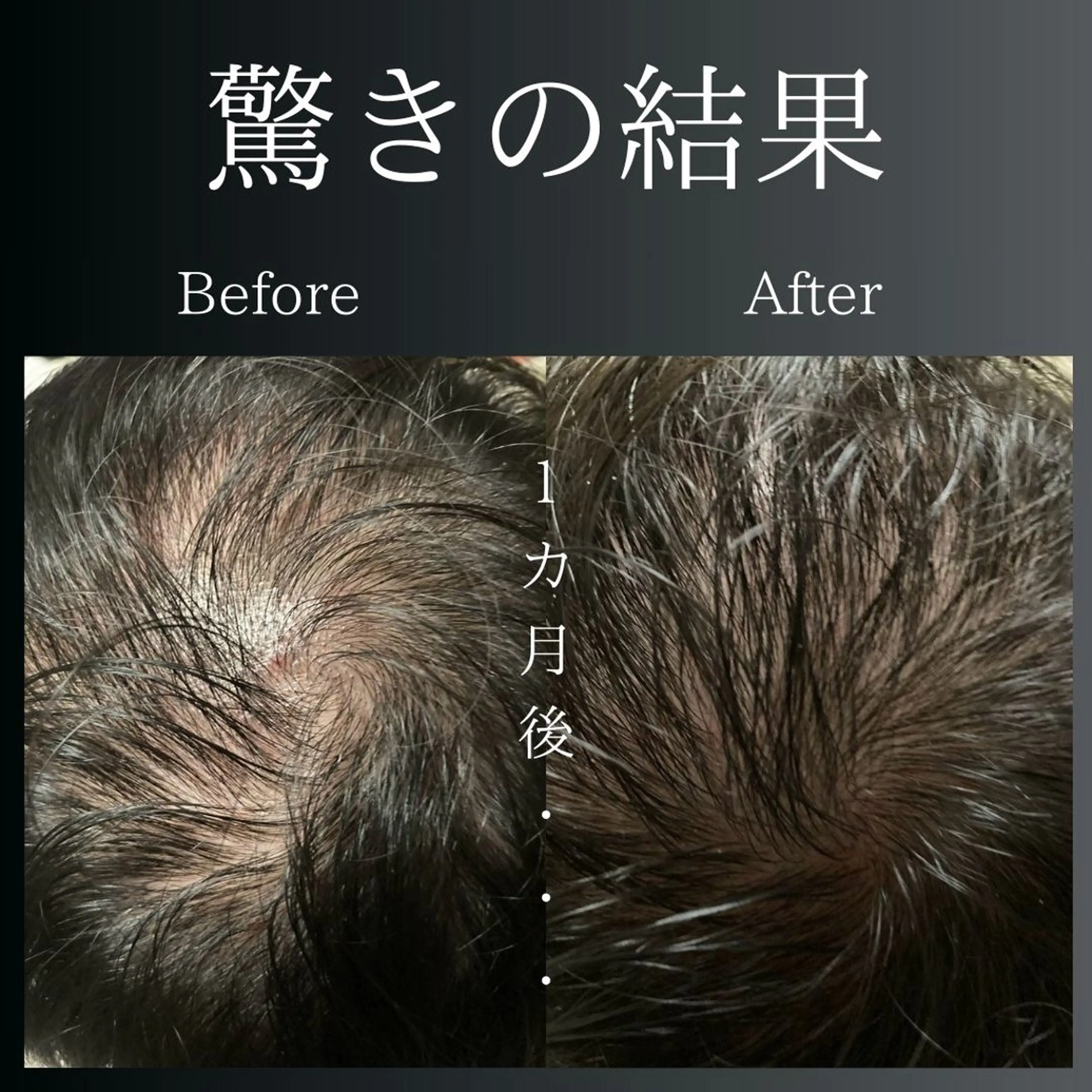 エステ LiZA エステティックサロンのエステ・リラクイメージ