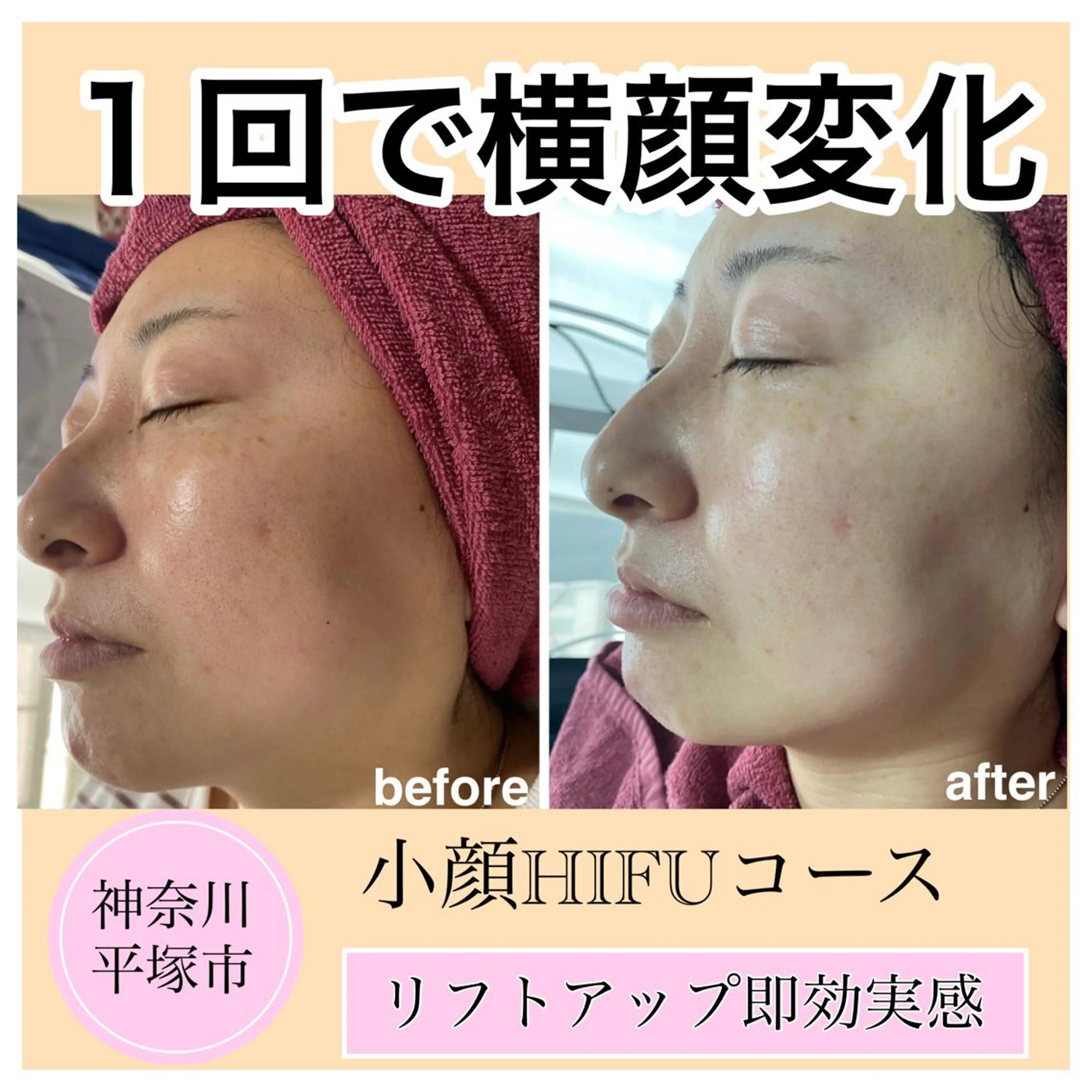 Chalon所属・REVI取扱・肌悩み 改善　Chalonのエステ・リラクイメージ
