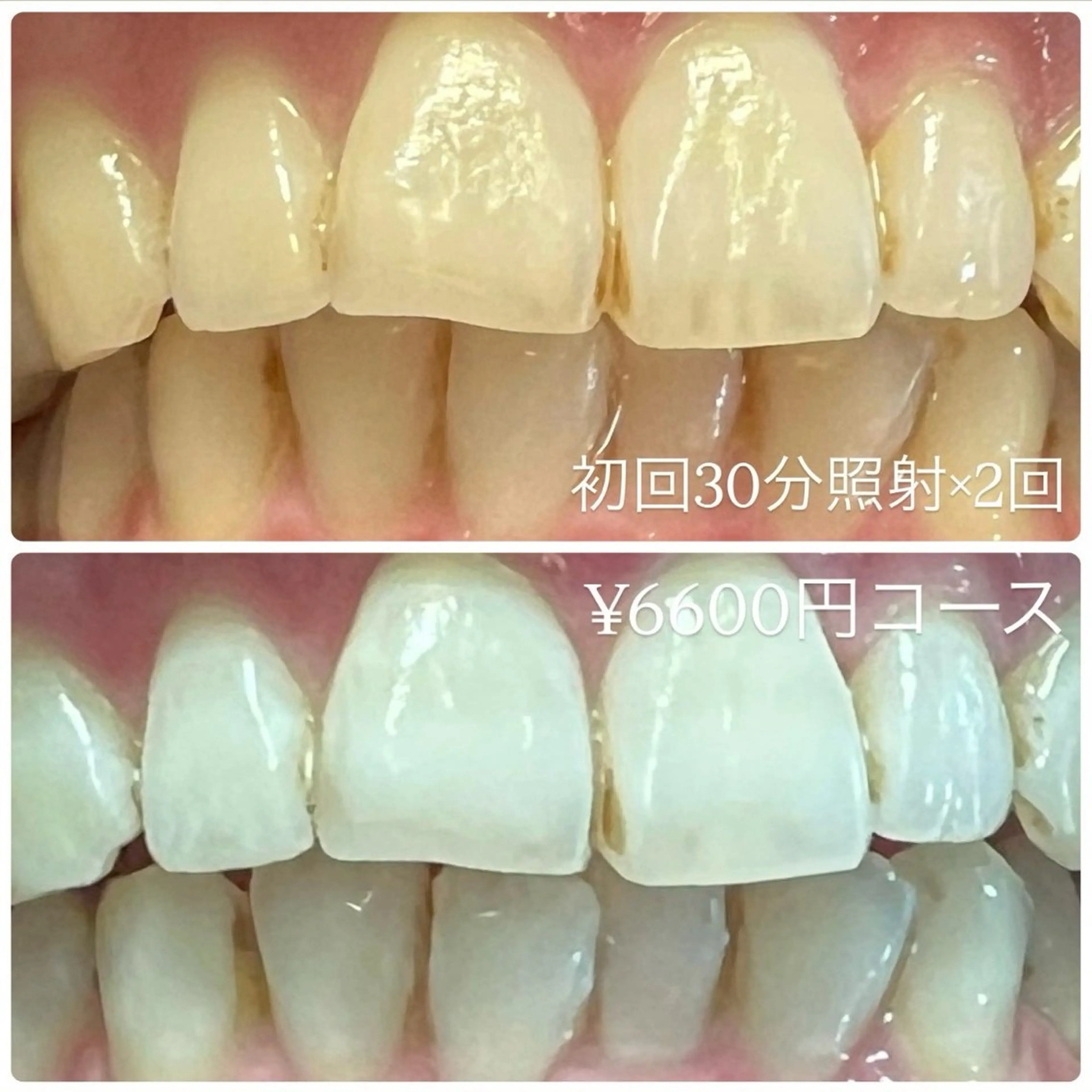 その他 PLATINUM Beauty 横浜店所属・ホワイトニングルーム 横浜店のその他イメージ