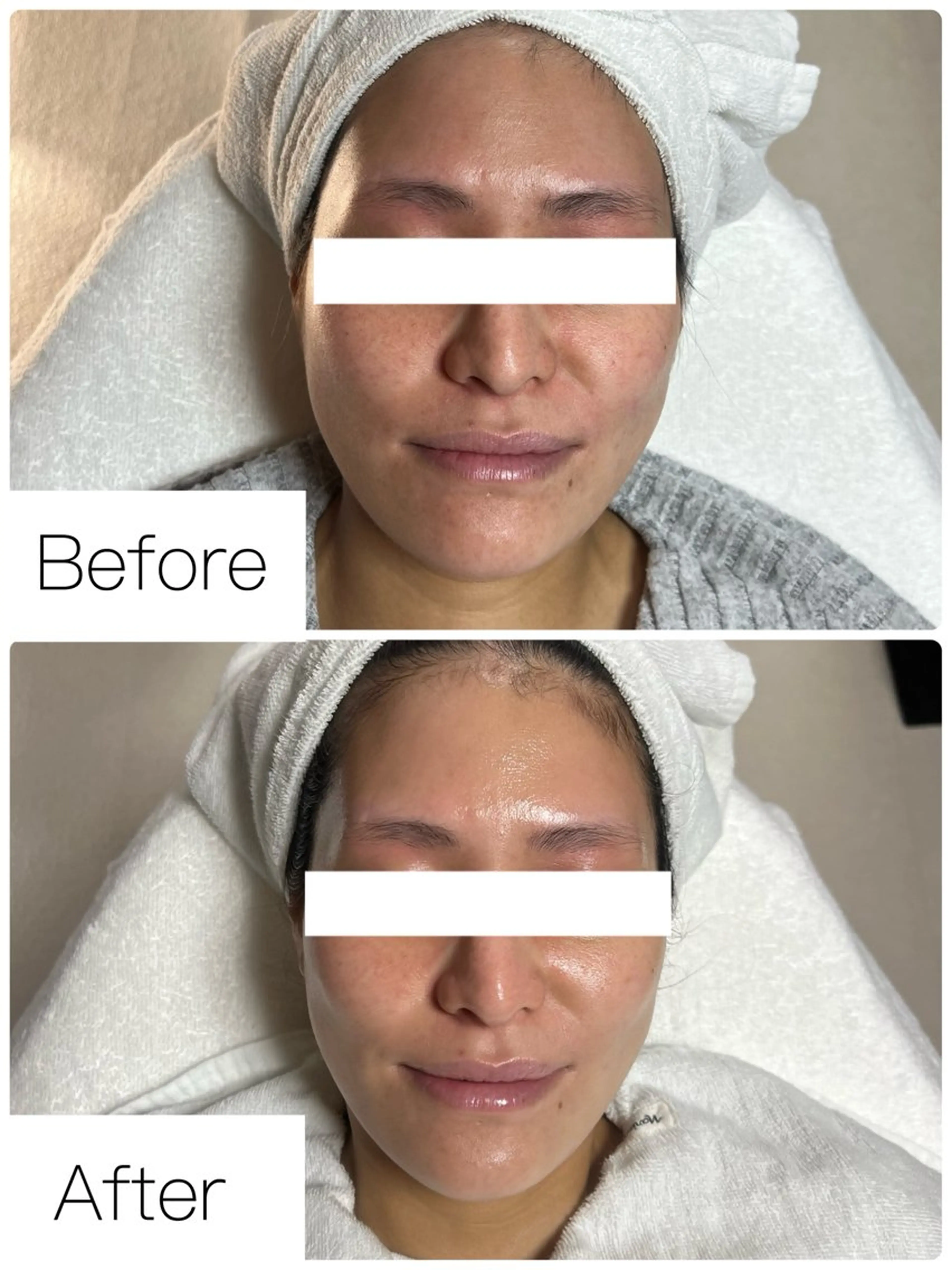 エステ ROR Akariのエステ・リラクイメージ