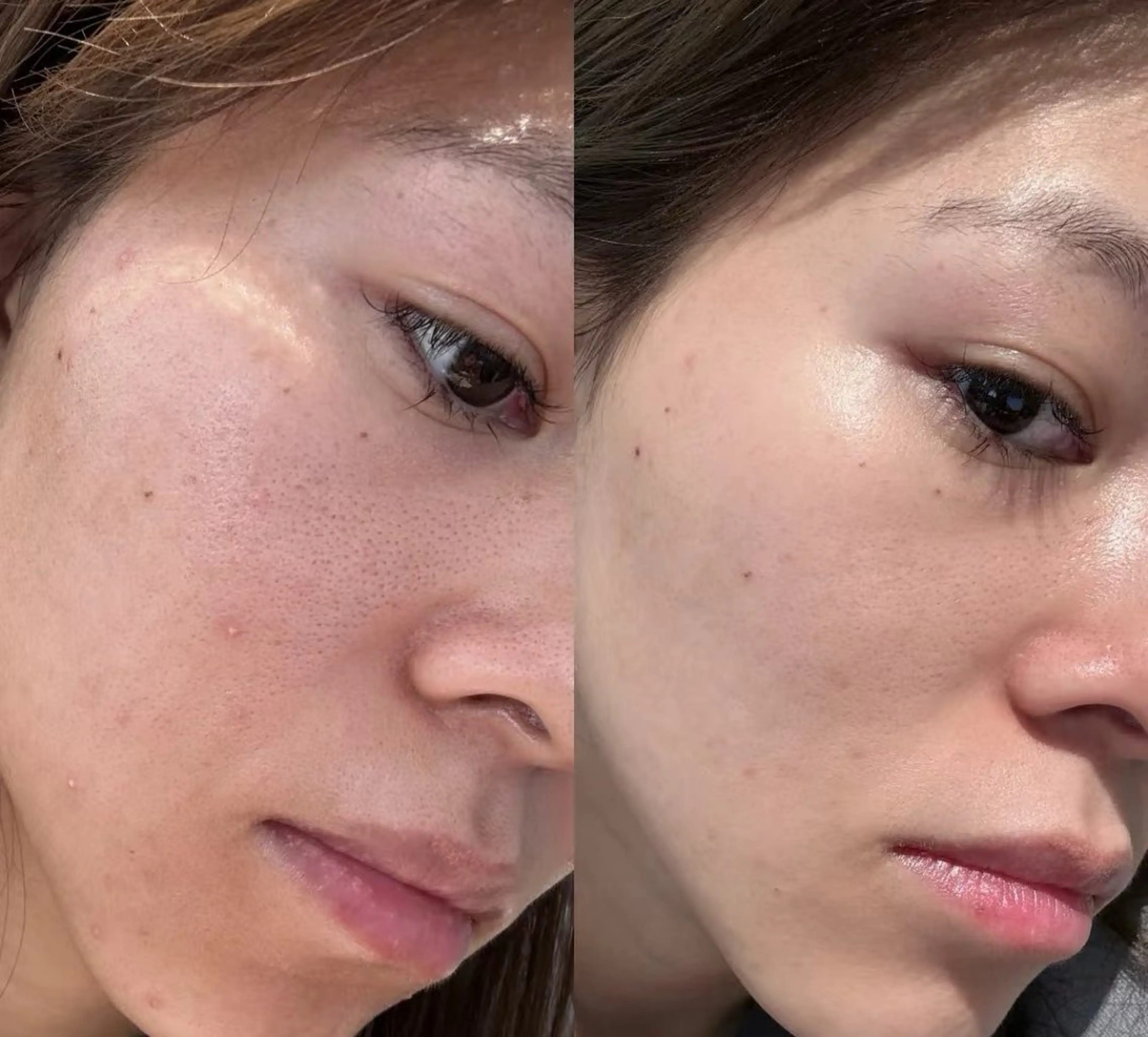 ネイル エステ aliaハイフ&水光ジェットサロン所属・aliaハーブ水光店 エステティシャン募集のエステ・リラクイメージ