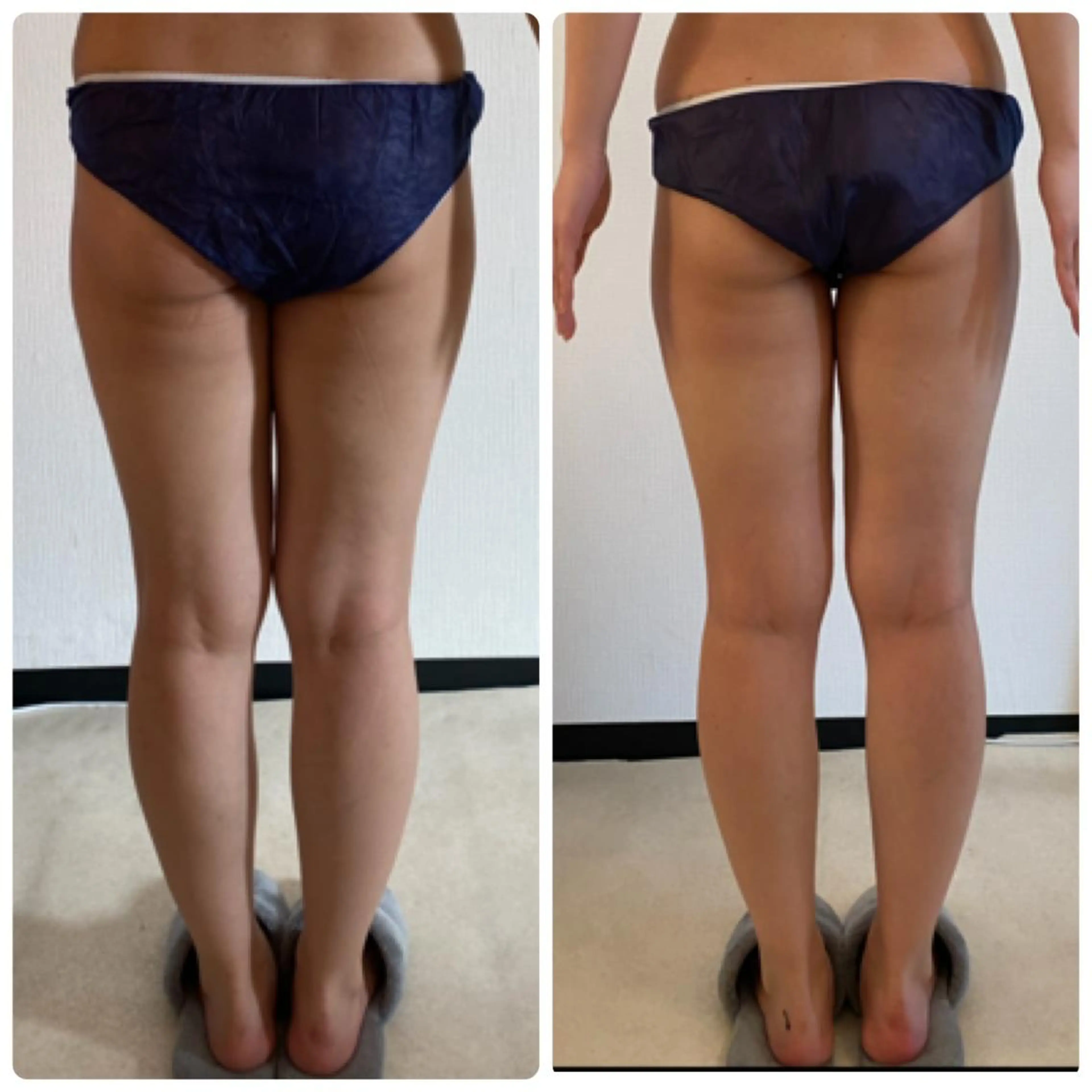 FLEUR大阪・整体 ・ハイフ・痩身・小顔のエステ・リラクイメージ