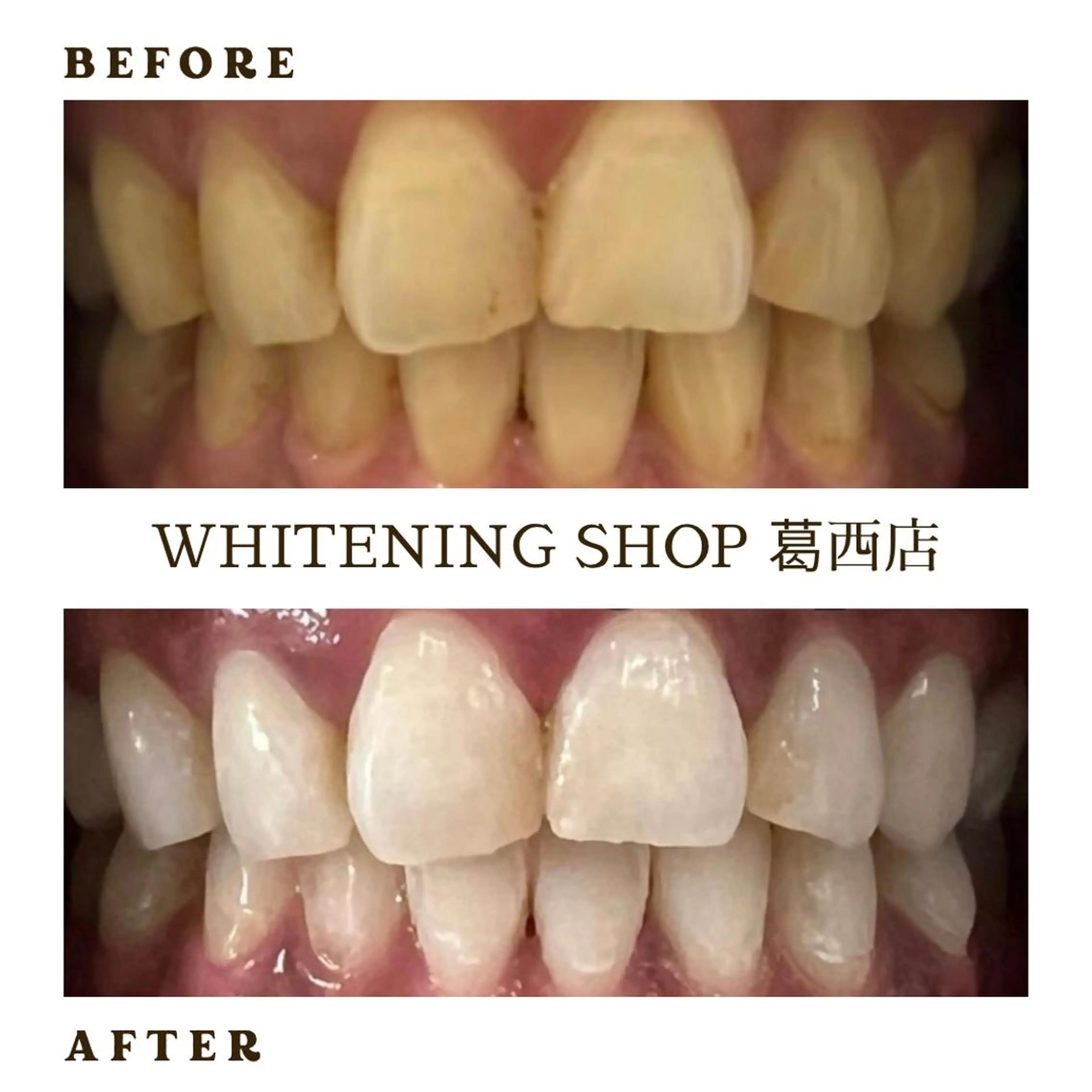 メンズ ホワイトニング ショップ葛西店のその他イメージ