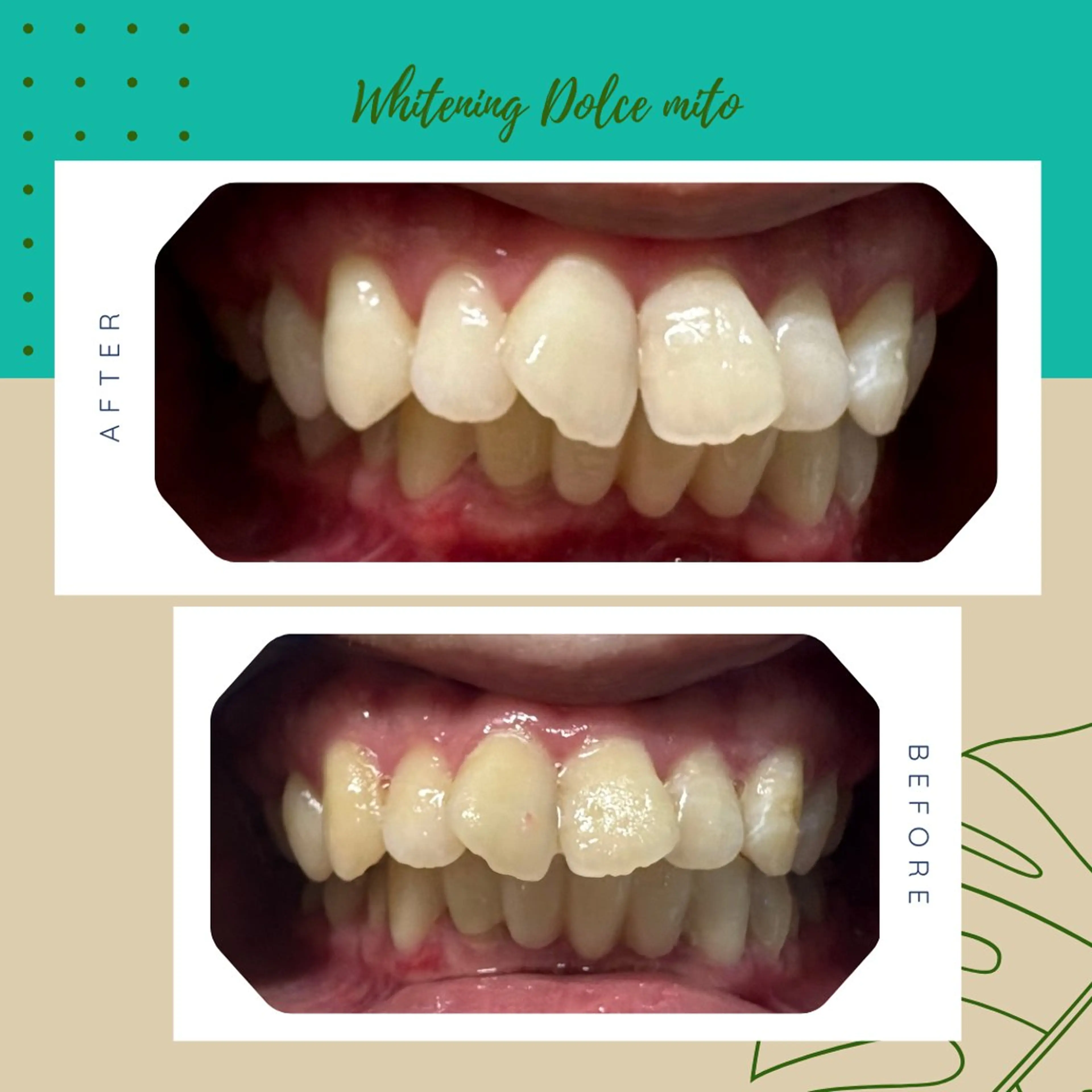 セルフホワイトニング Dolce水戸店のその他イメージ