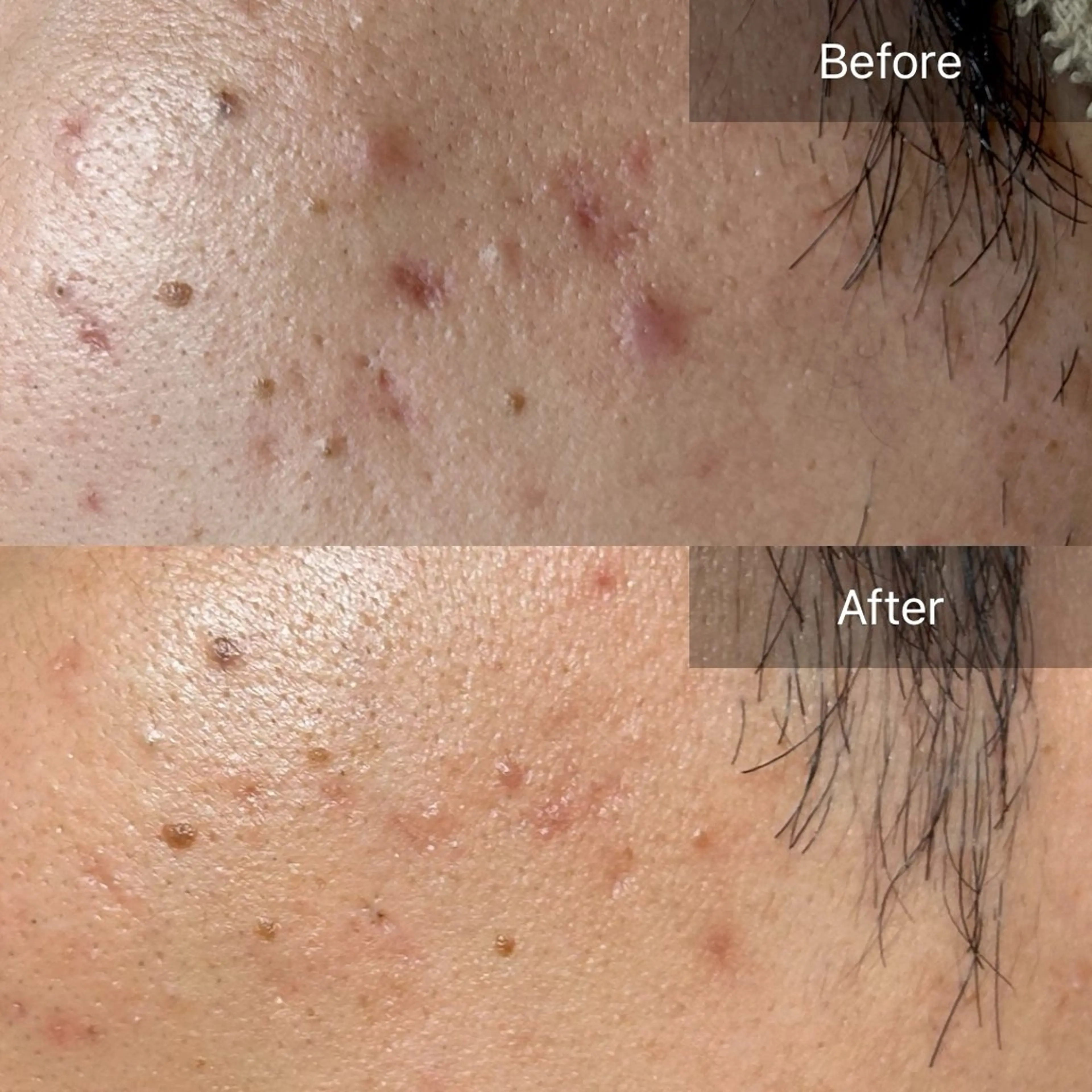 エステ clé skin 🌿ハーブピーリングのエステ・リラクイメージ