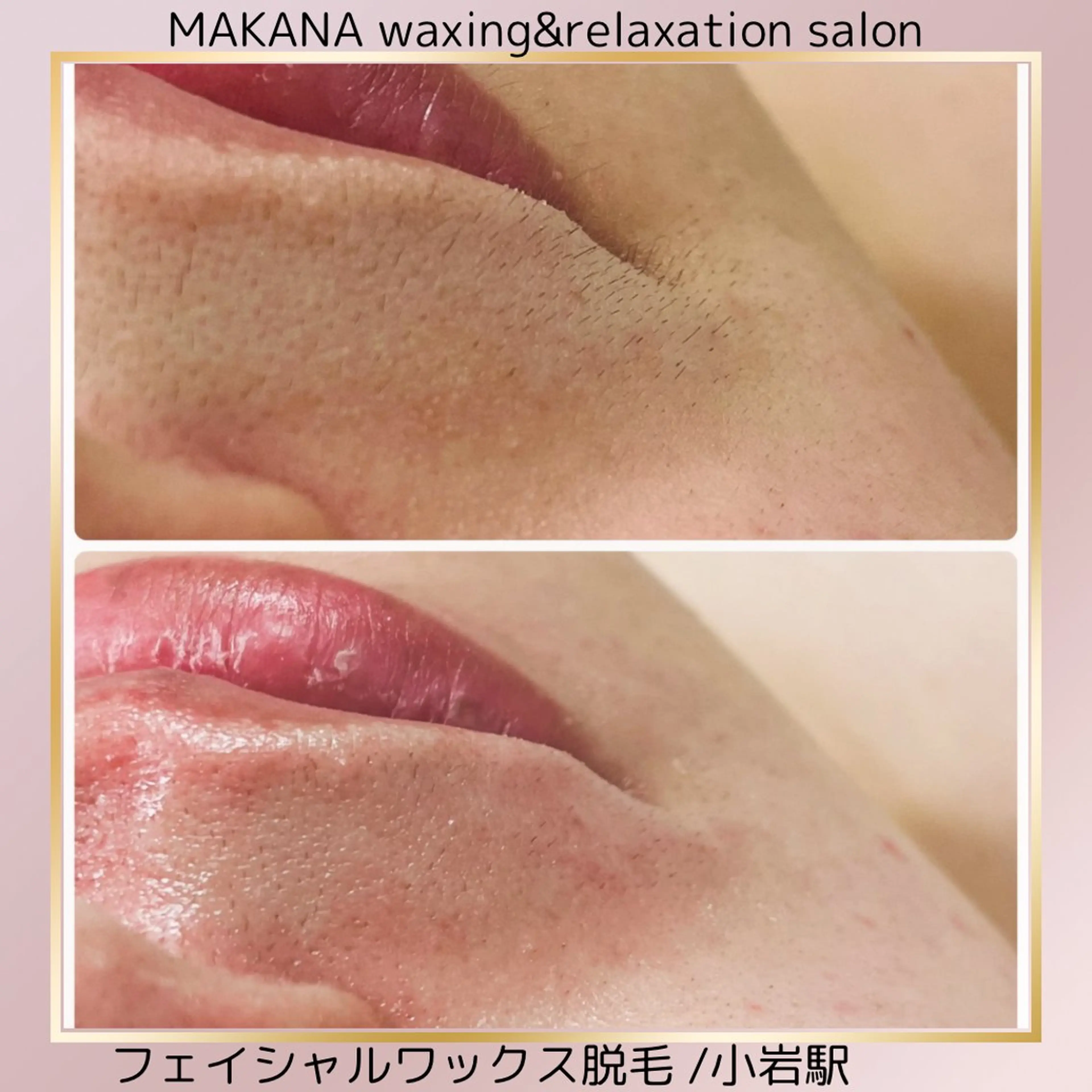 脱毛 MAKANA waxing&relaxation所属・MAKANA 吉岡 小岩店のエステ・リラクイメージ