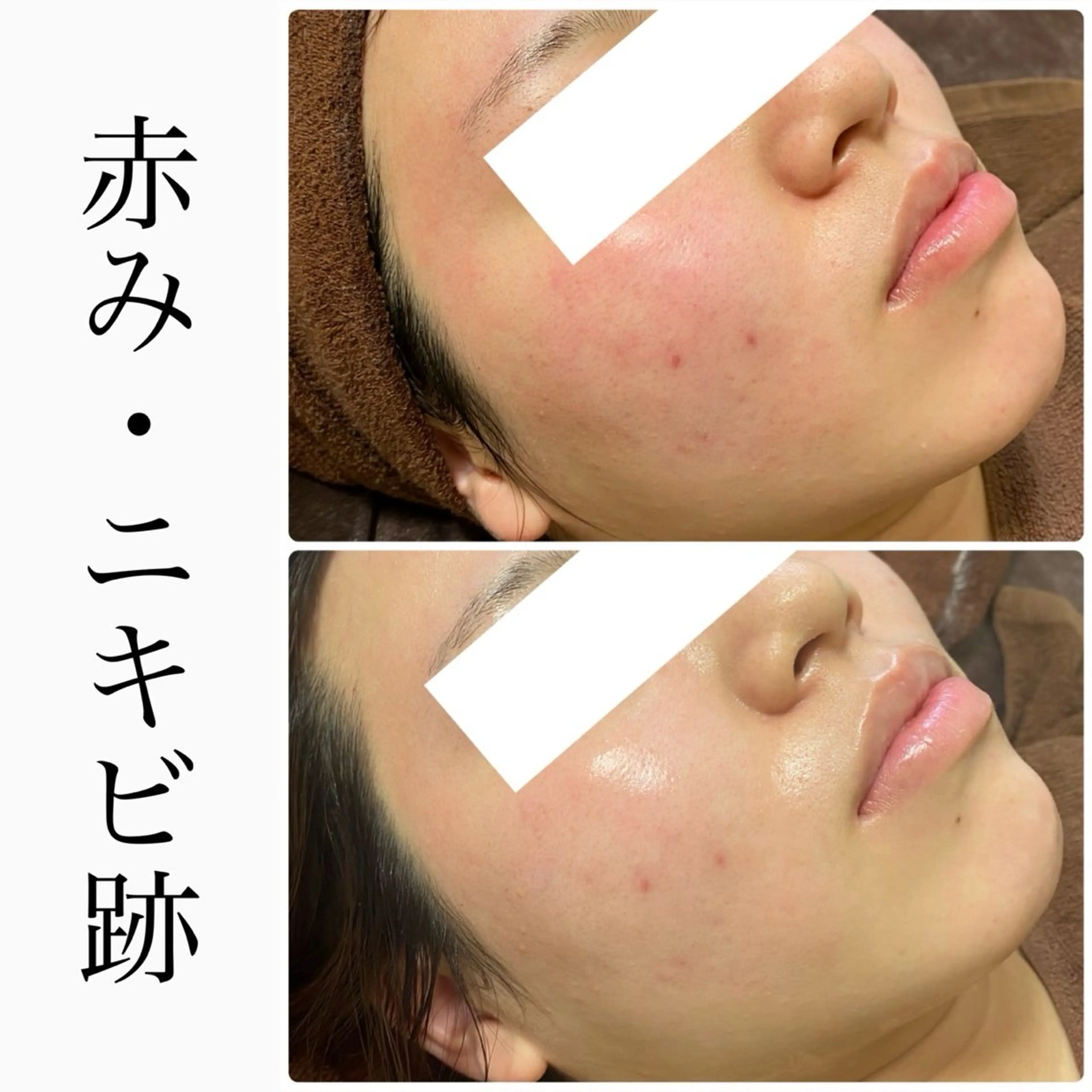 ハーブピーリング専門 BIOEL横浜のエステ・リラクイメージ