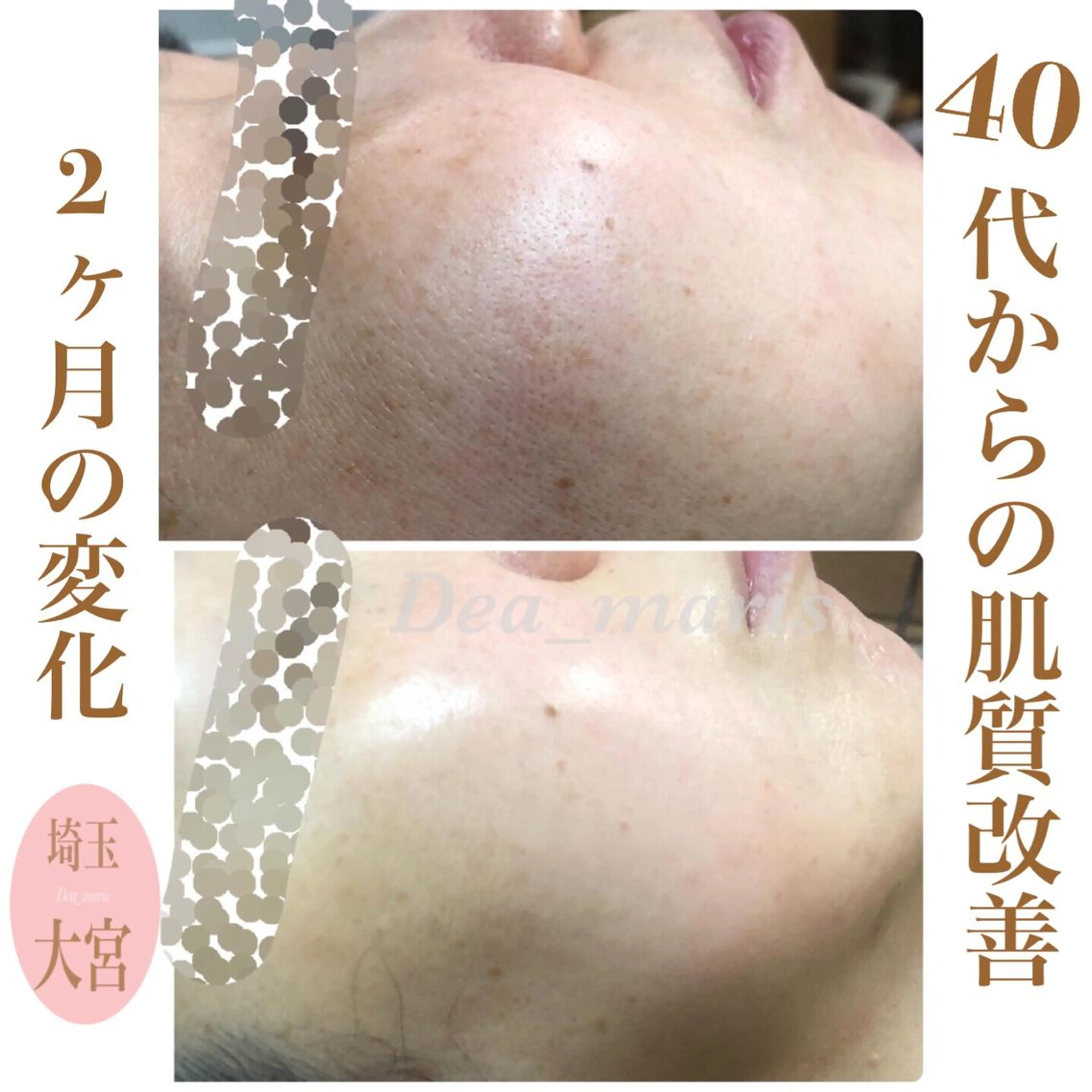 private salon  Dea_maris シュガーリング＆パーソナルボディケア所属・グランプリ受賞👑肌 体も別人級に変えるのその他イメージ