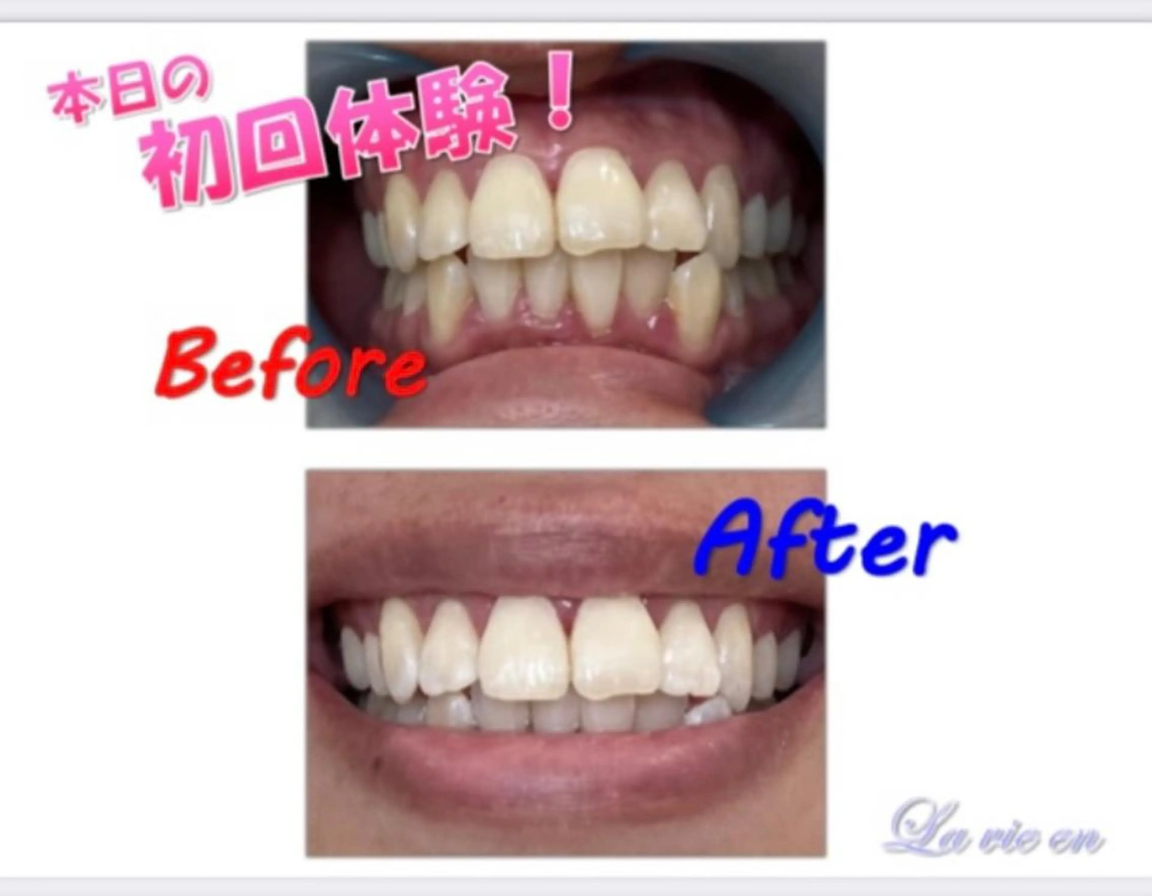 その他 セルフホワイトニングサロン　ラヴィアン所属・ホワイトニングサロン La vie enのその他イメージ