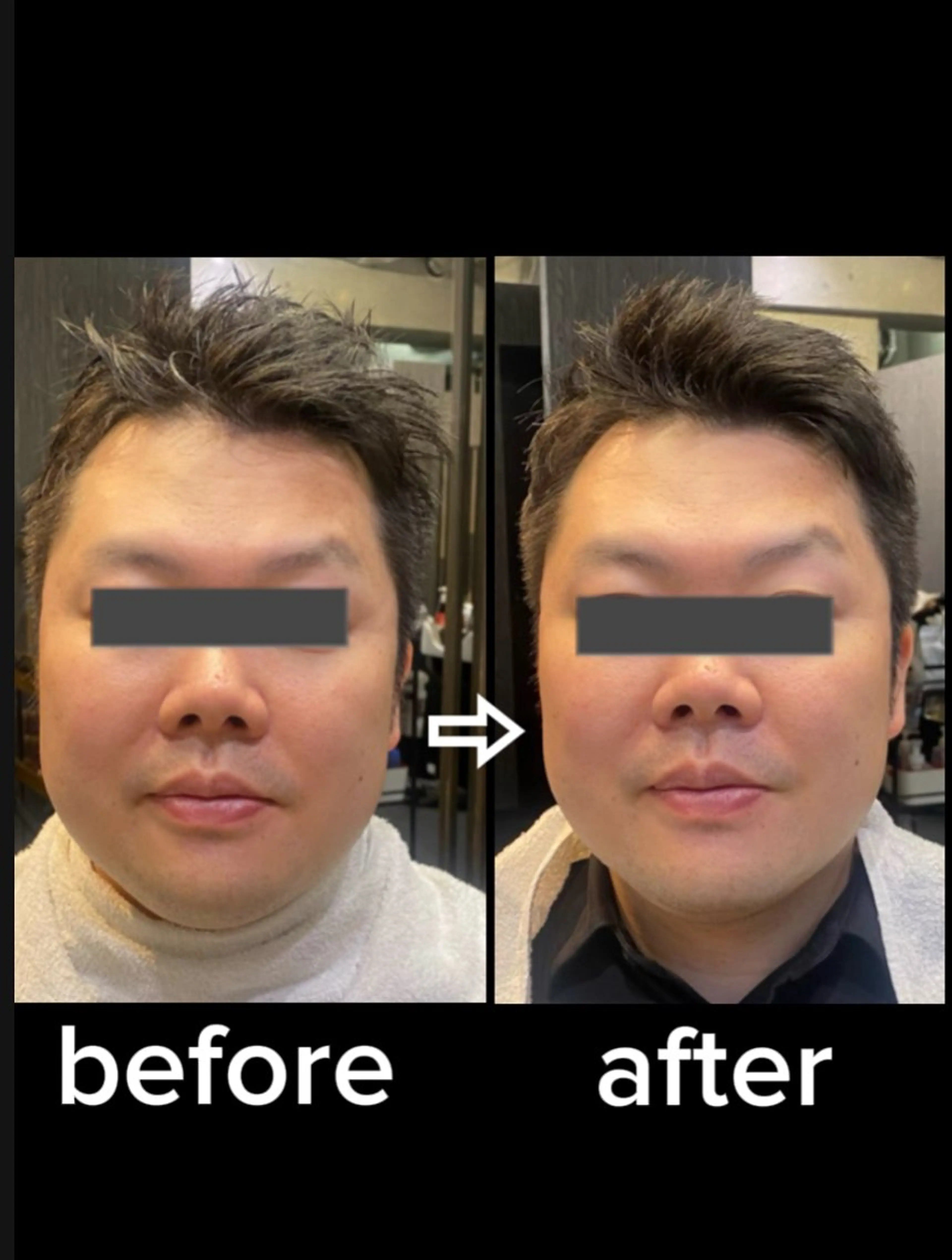 頭蓋骨整形ヘッドマッサージの写真