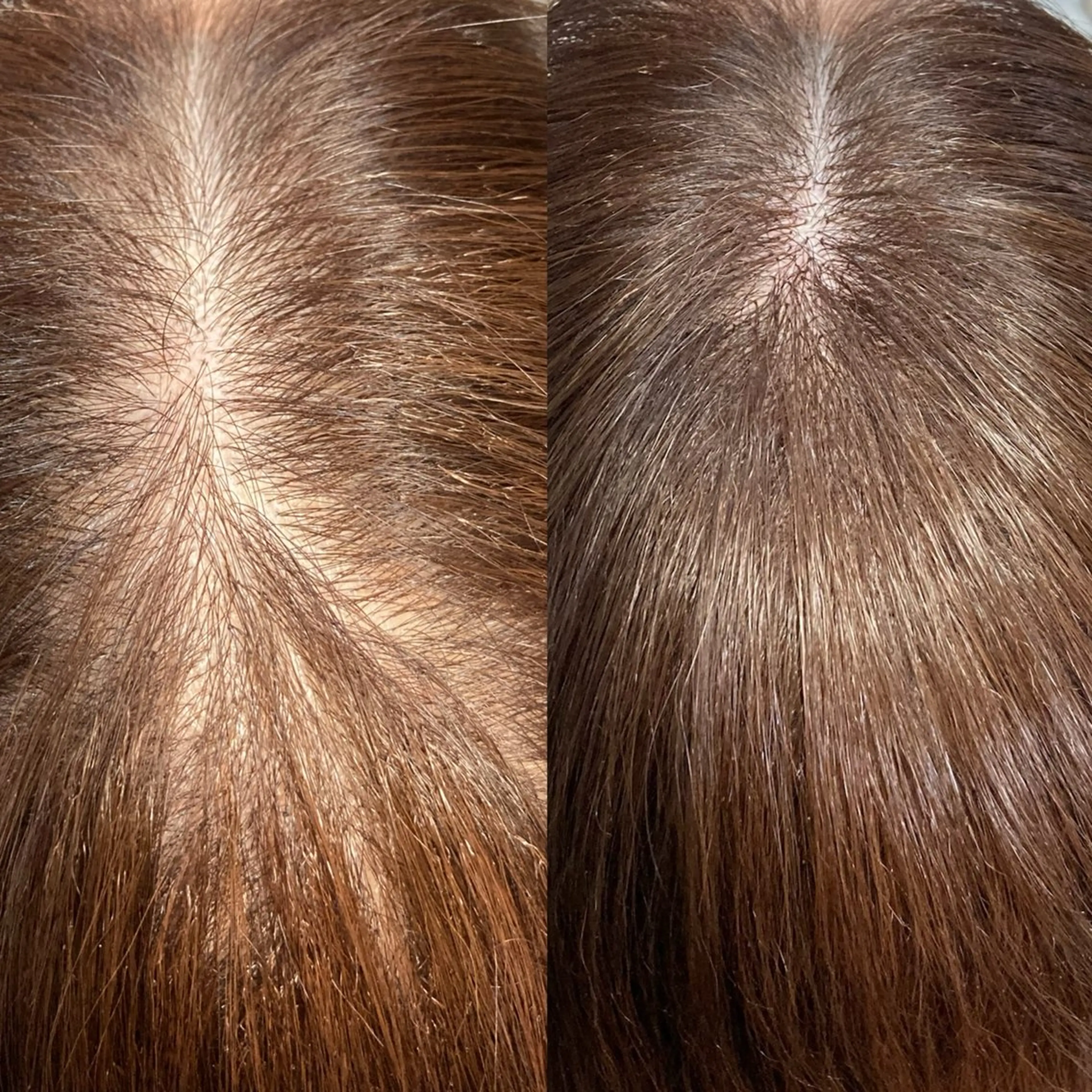 エクステ 25ニコ所属・25 ニコのヘアスタイル