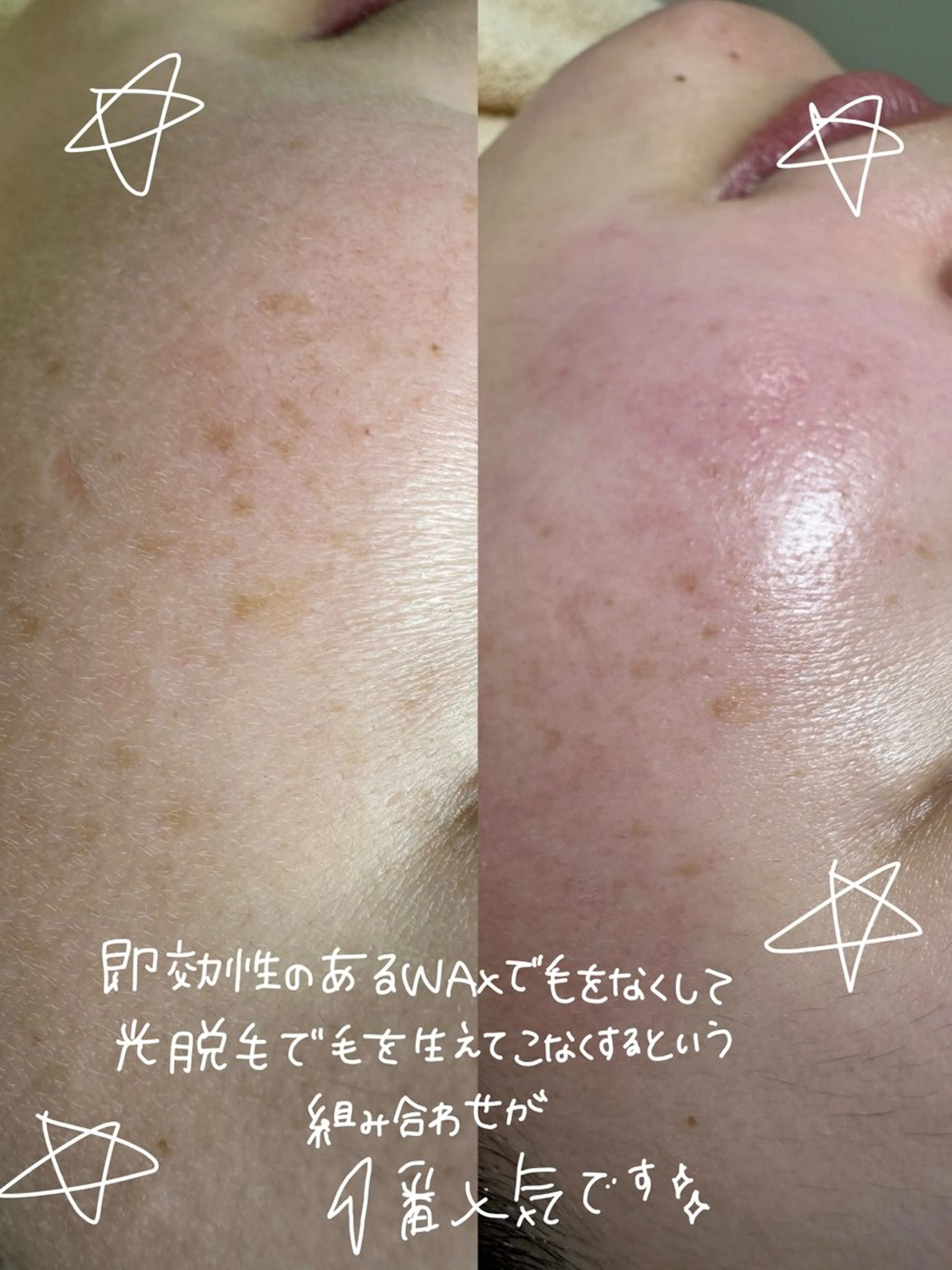 UNI ~mizuki~のエステ・リラクイメージ