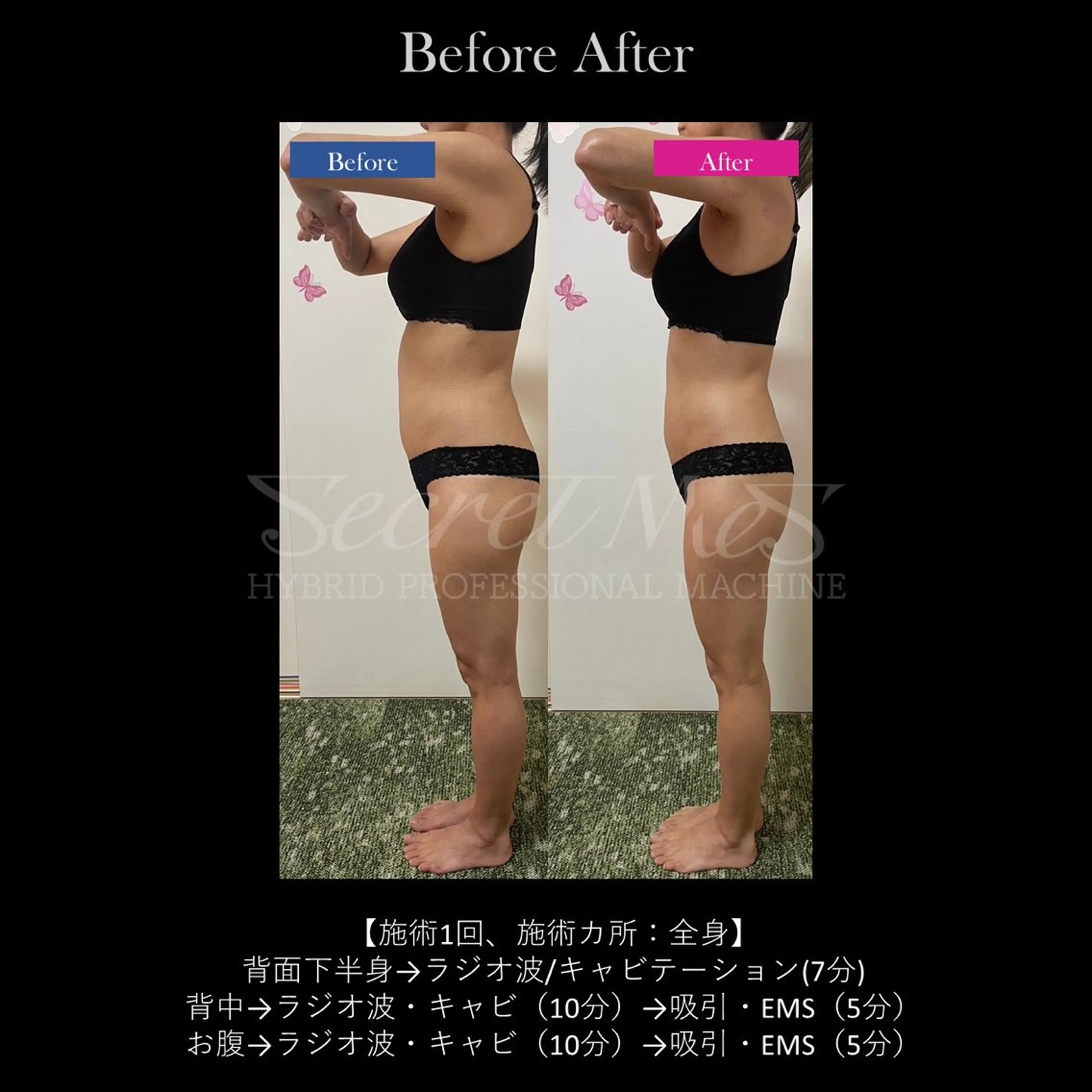 エステ リラク 美容痩身×韓国肌管理 W.beautyのエステ・リラクイメージ