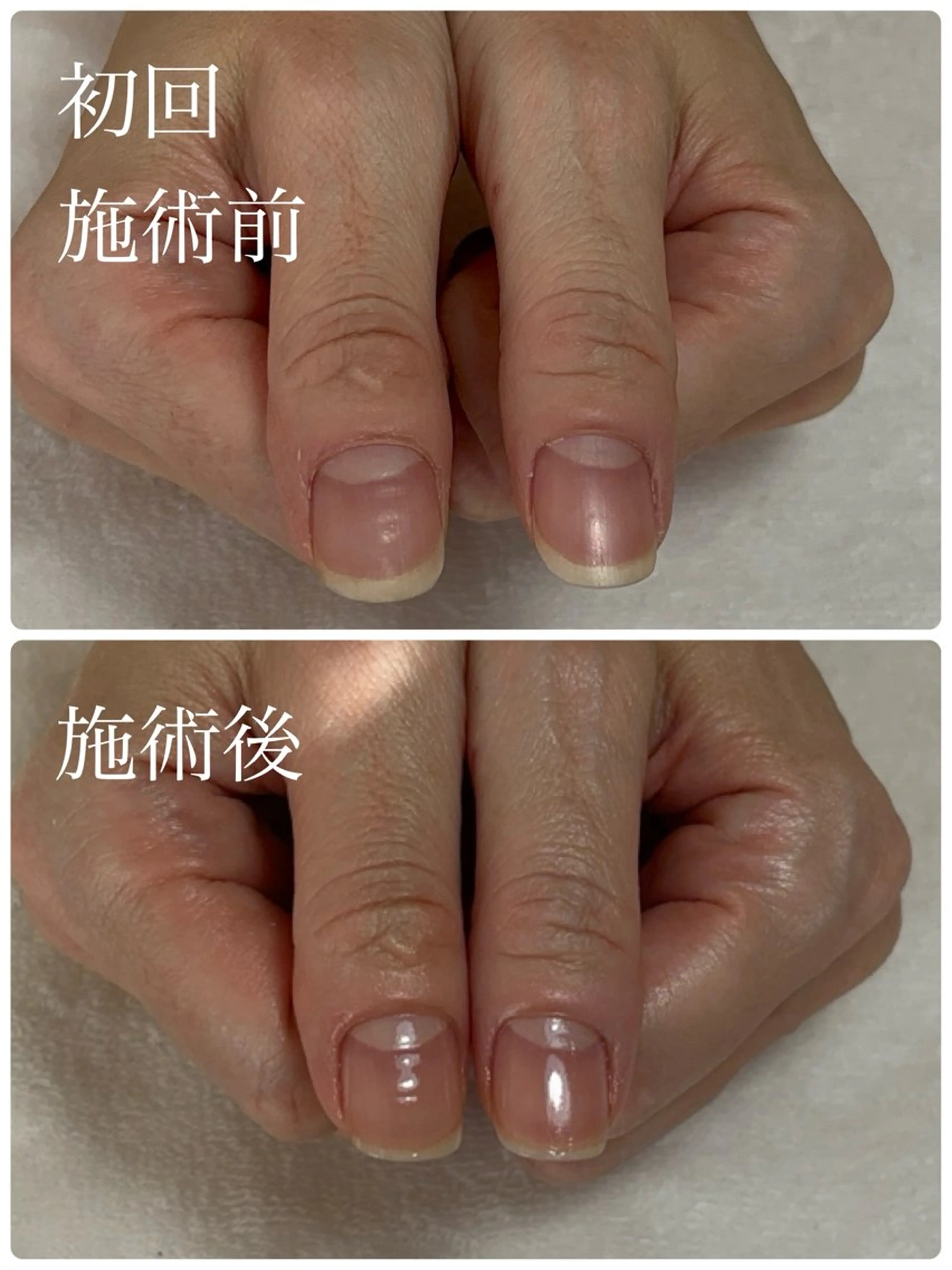 ネイル 卒業式 ハンドネイル ハンドケア Alo.nail アロ•ネイルのネイルデザイン