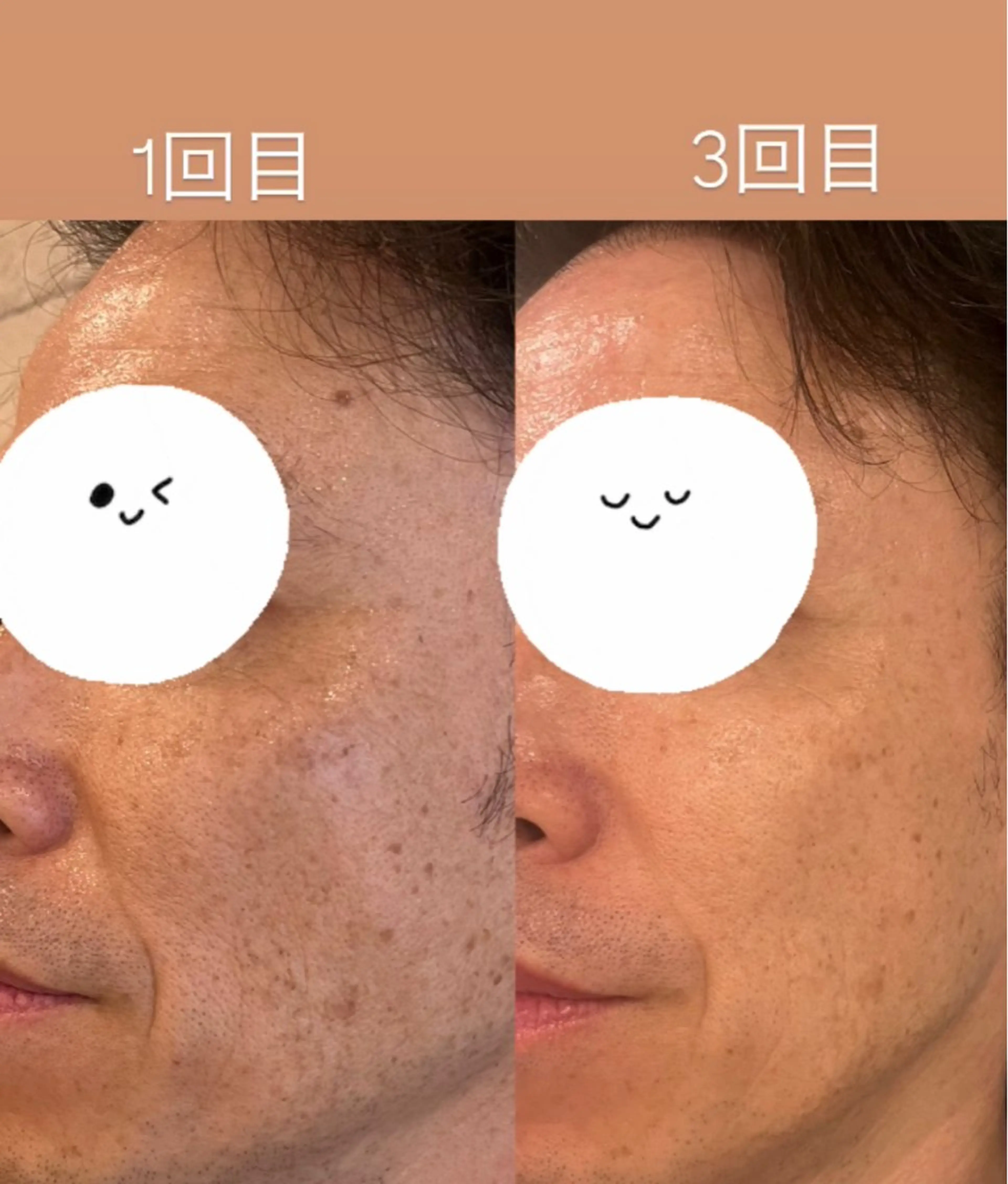 ツヤ肌🫧肌育joo 腸セラピー🌿高岳のエステ・リラクイメージ