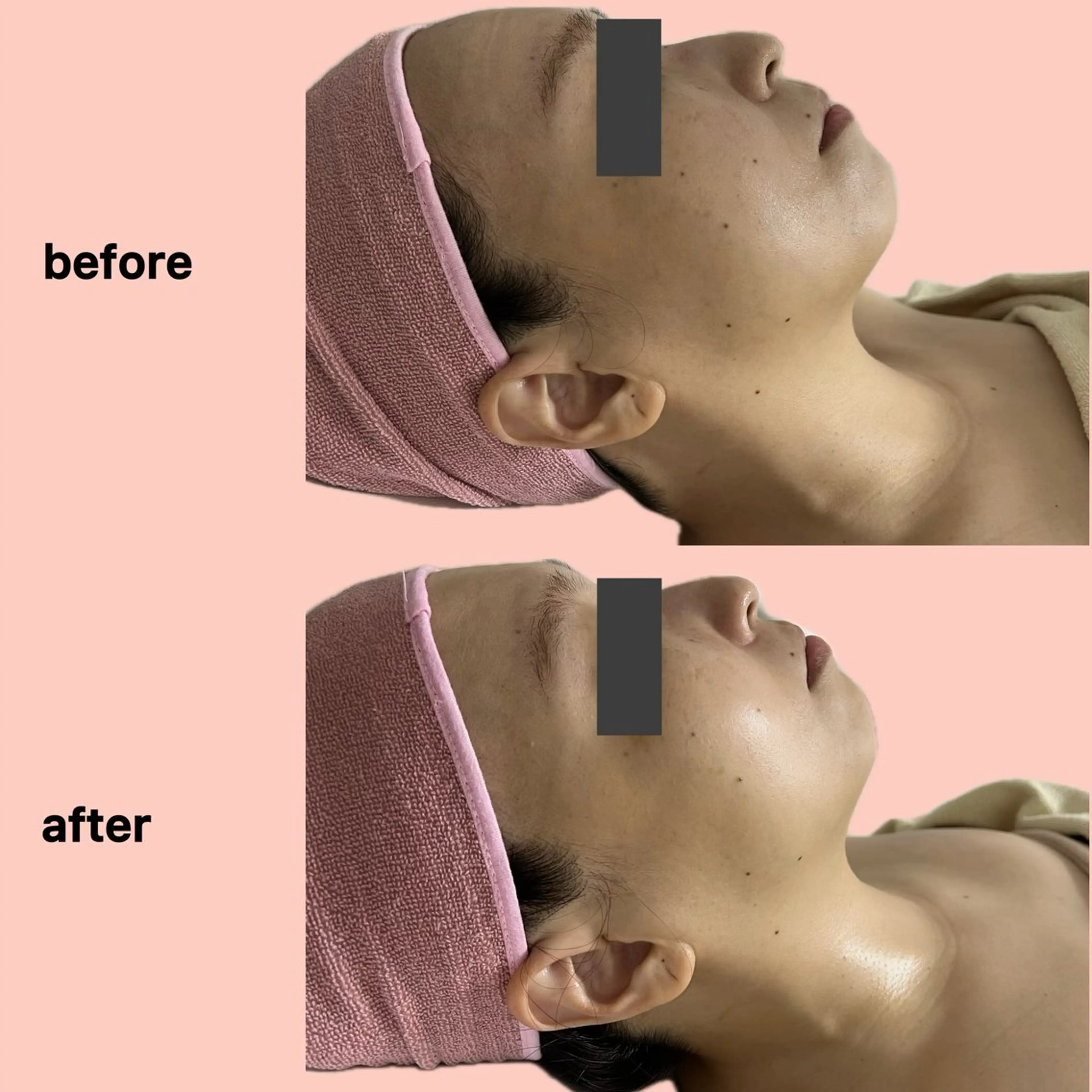 エステ gleam ü 枚方公園のエステ・リラクイメージ