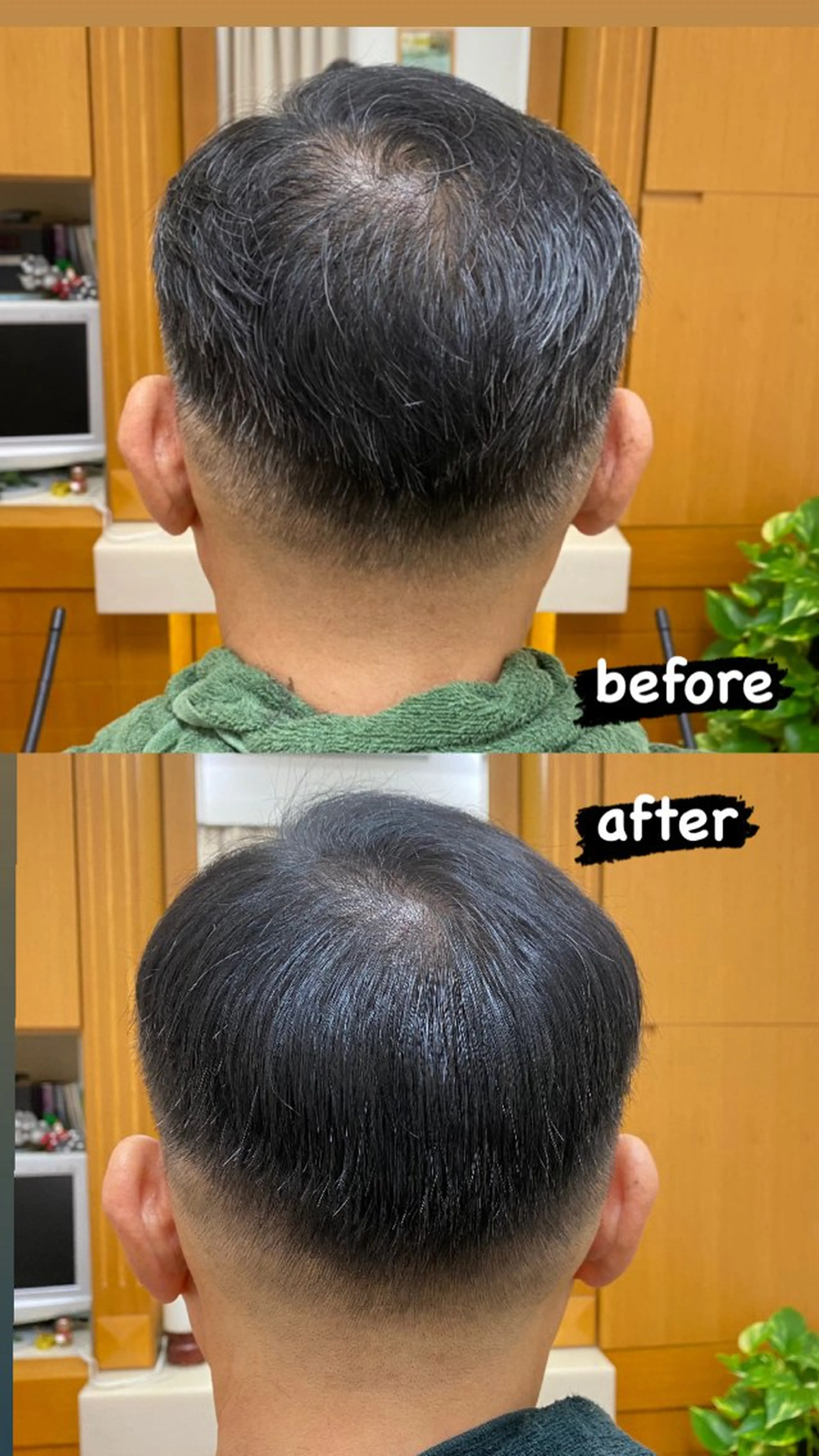 白髪染めの写真