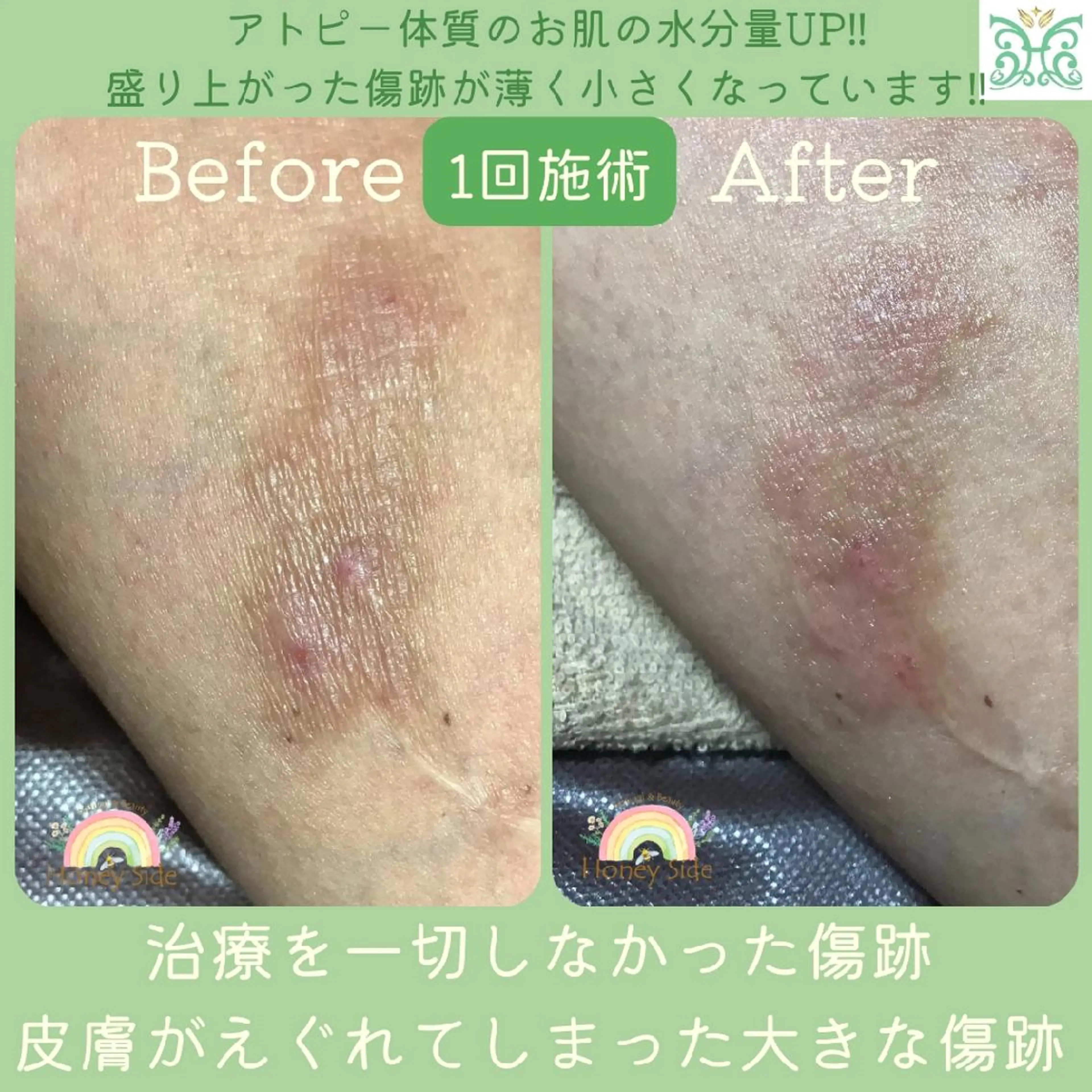 エステ 剥離するハーブ🌈 Honey Sideのエステ・リラクイメージ
