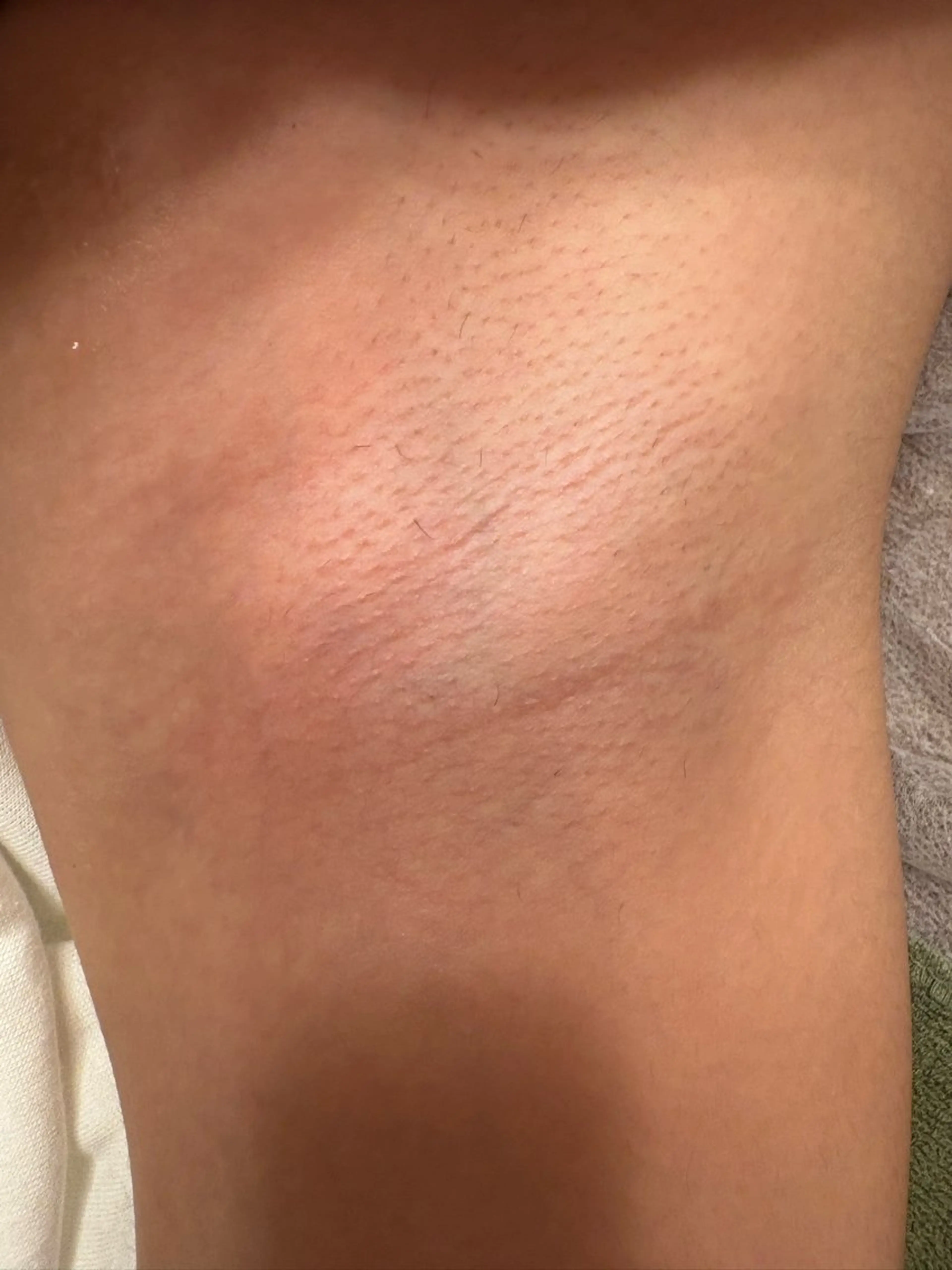 脱毛Salon王都呼所属・脱毛Salon王都呼 NAOKOのエステ・リラクイメージ