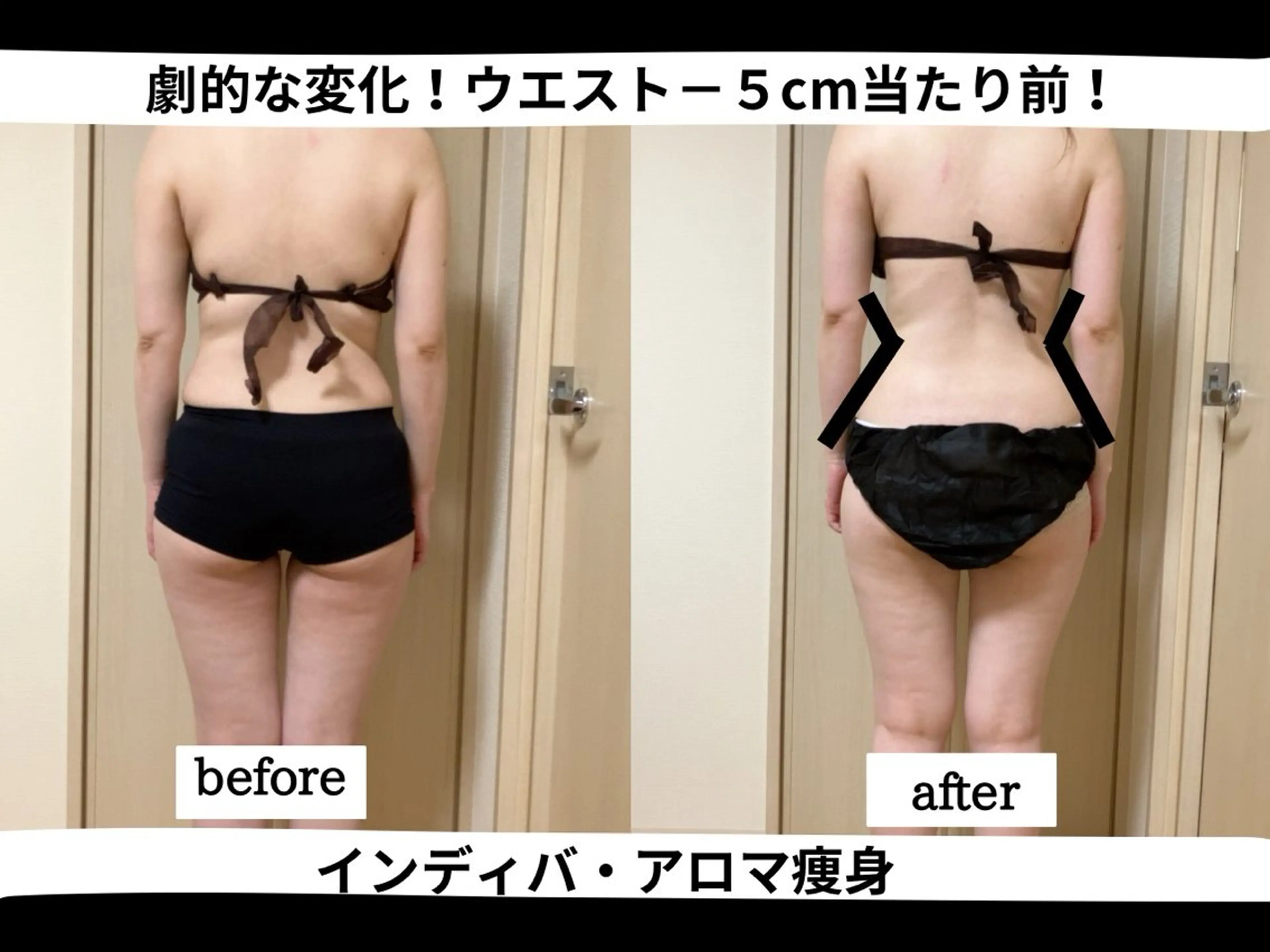 人気NO1！【最強のインディバ＆アロマ痩身90分】まずお試し！¥19800→¥9900の写真
