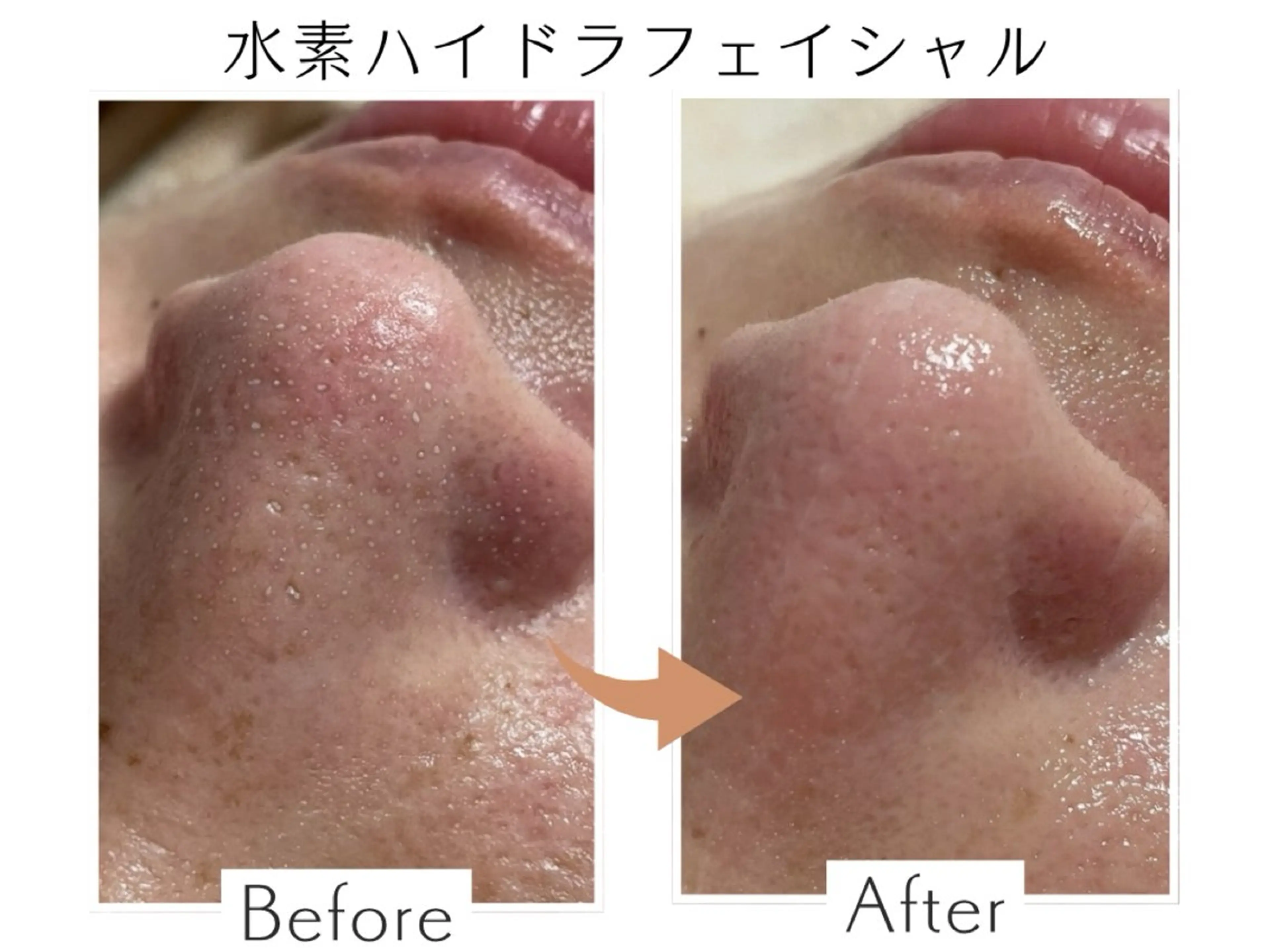 エステ リラク プライベートサロン Belle（ベル）のエステ・リラクイメージ