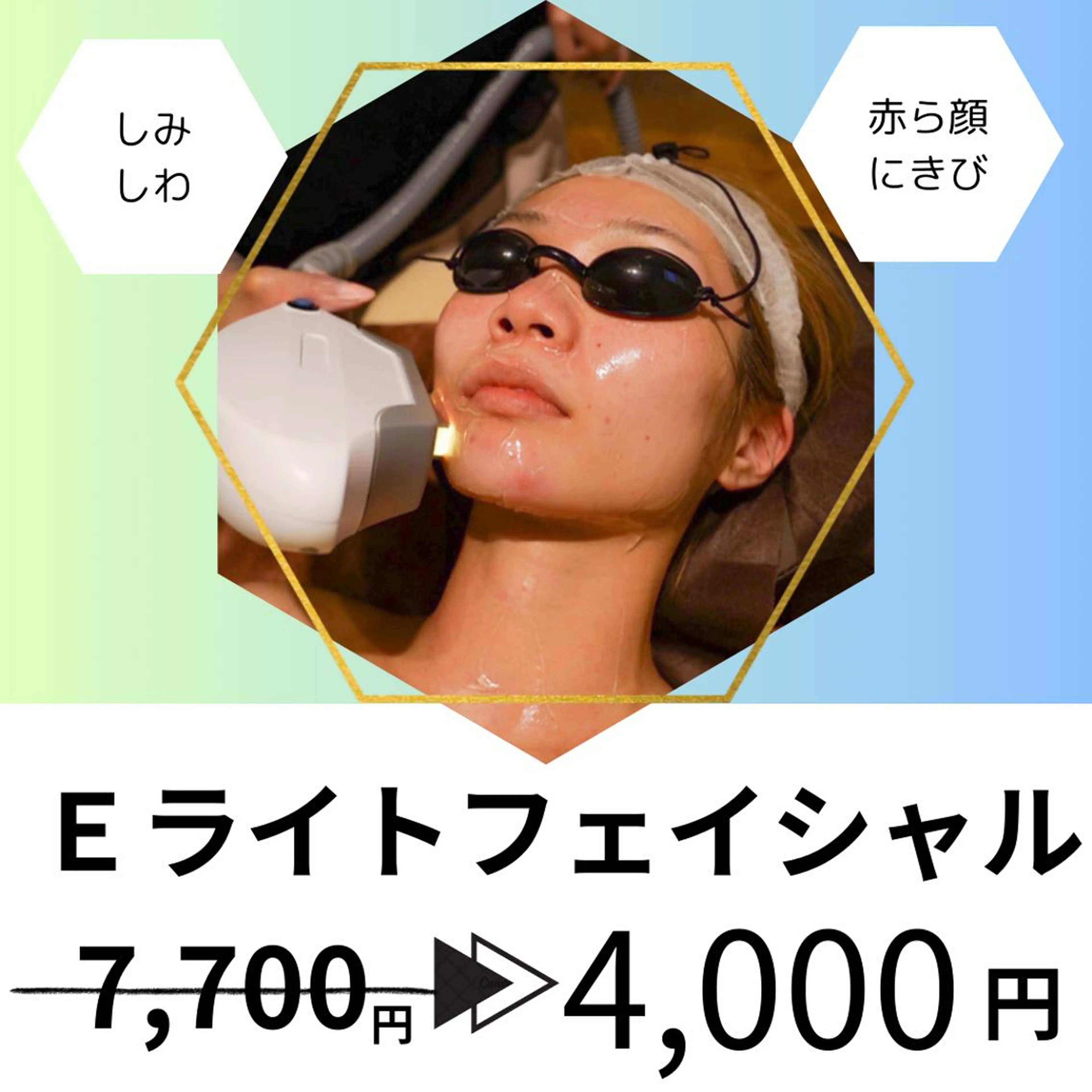 20代から始める脱毛 salonLEPIAのエステ・リラクイメージ