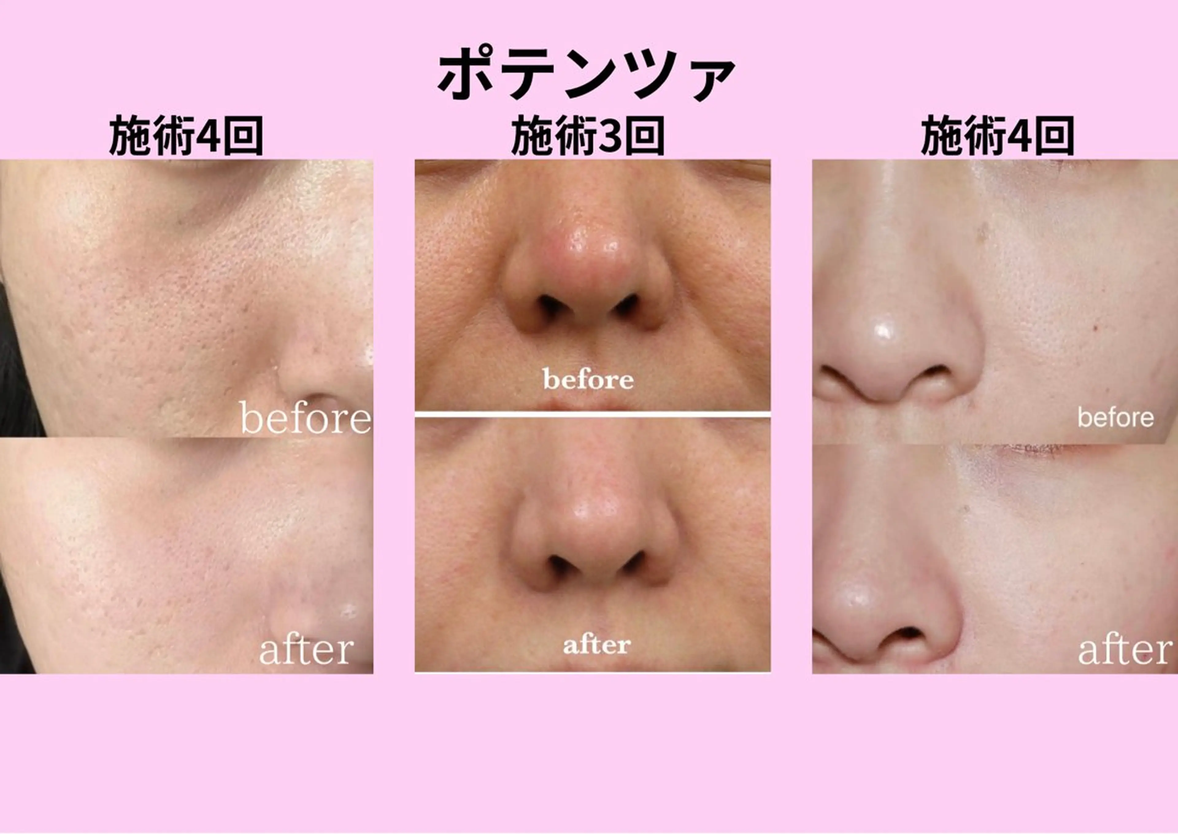 ショート エステ リラク 愛維美水光美肌専門店所属・愛維美水光美肌専門店 メンズレディースokのエステ・リラクイメージ
