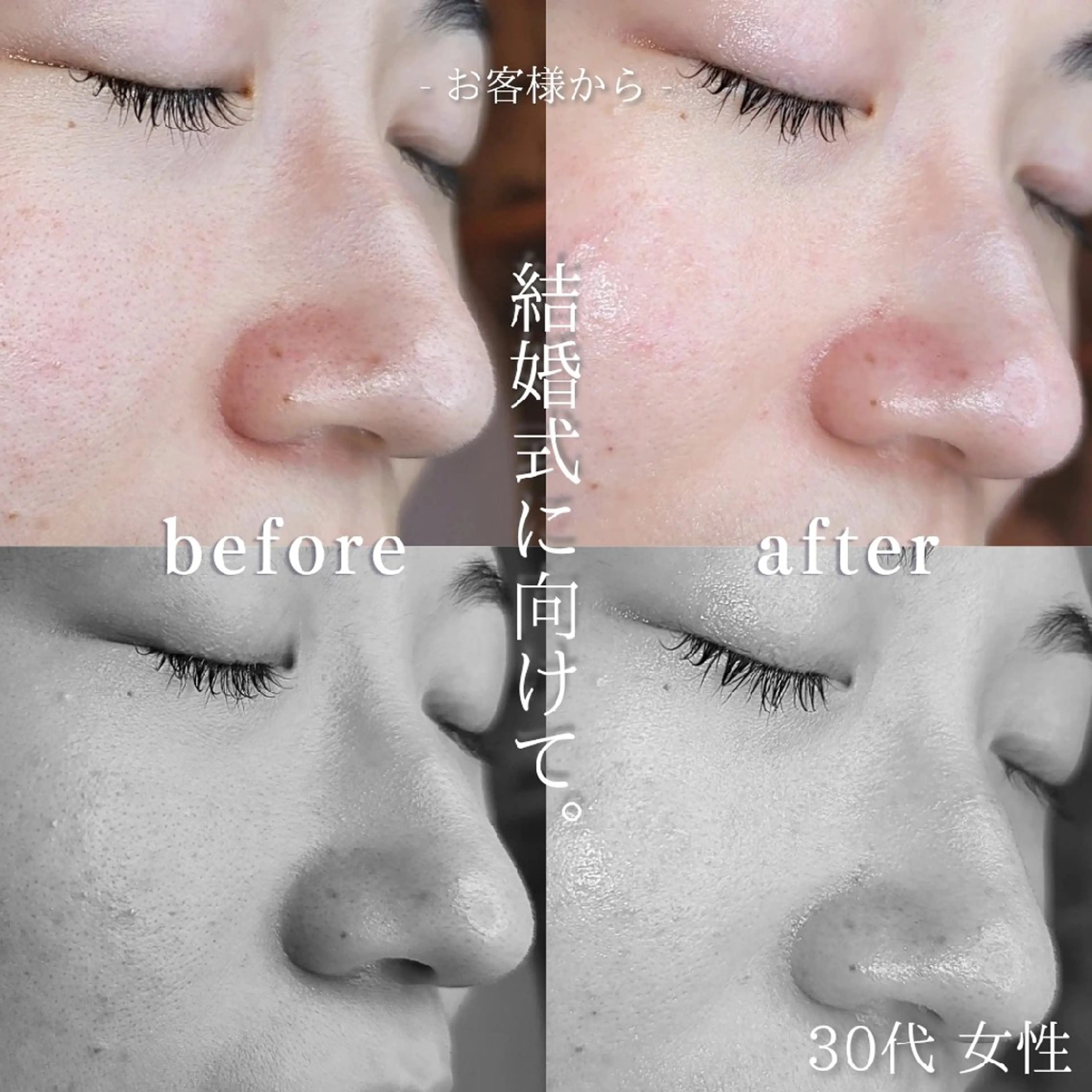 era: kayla 毛穴・ニキビ改善のエステ・リラクイメージ