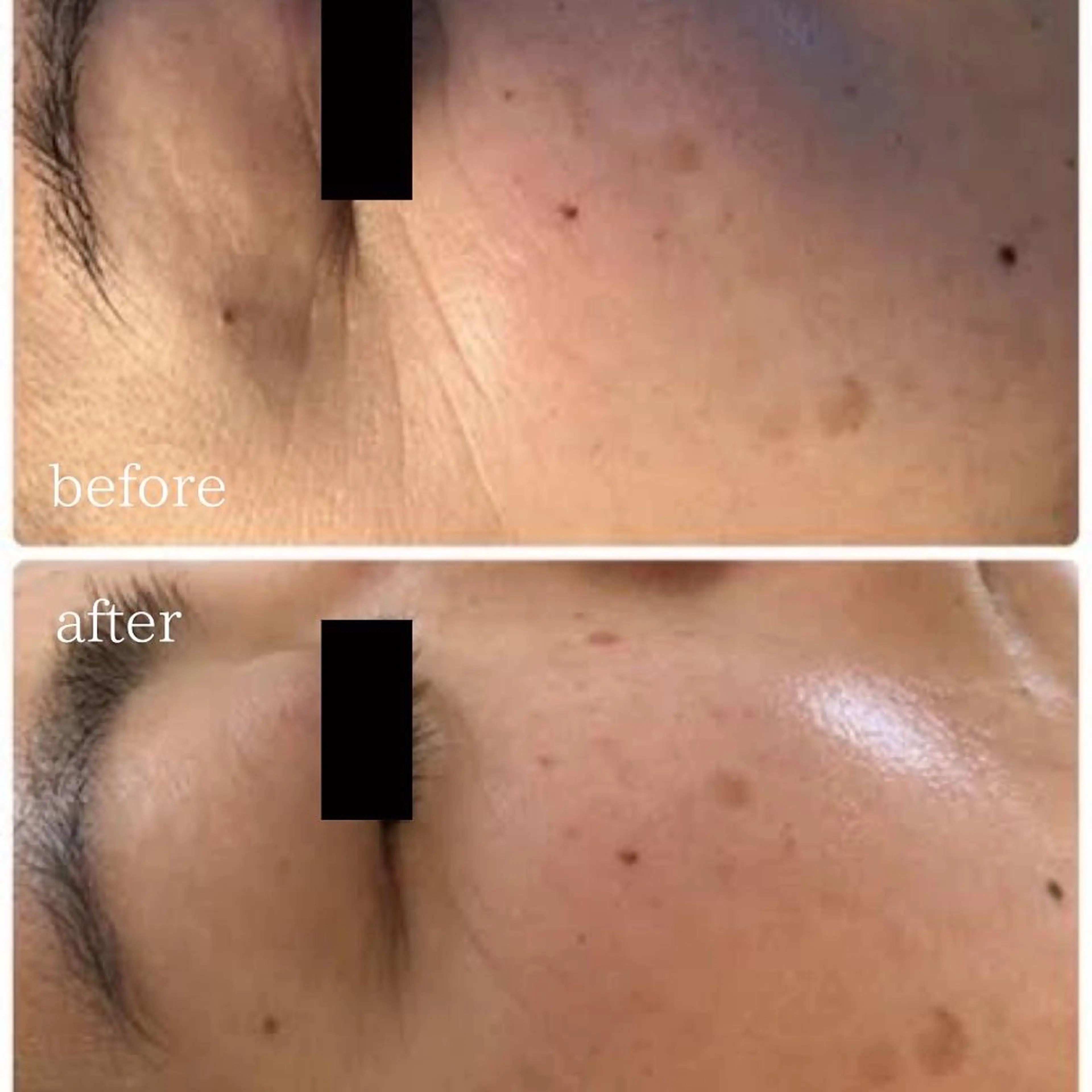 エステ リラク É LINDA所属・E LINDAのネイルデザイン