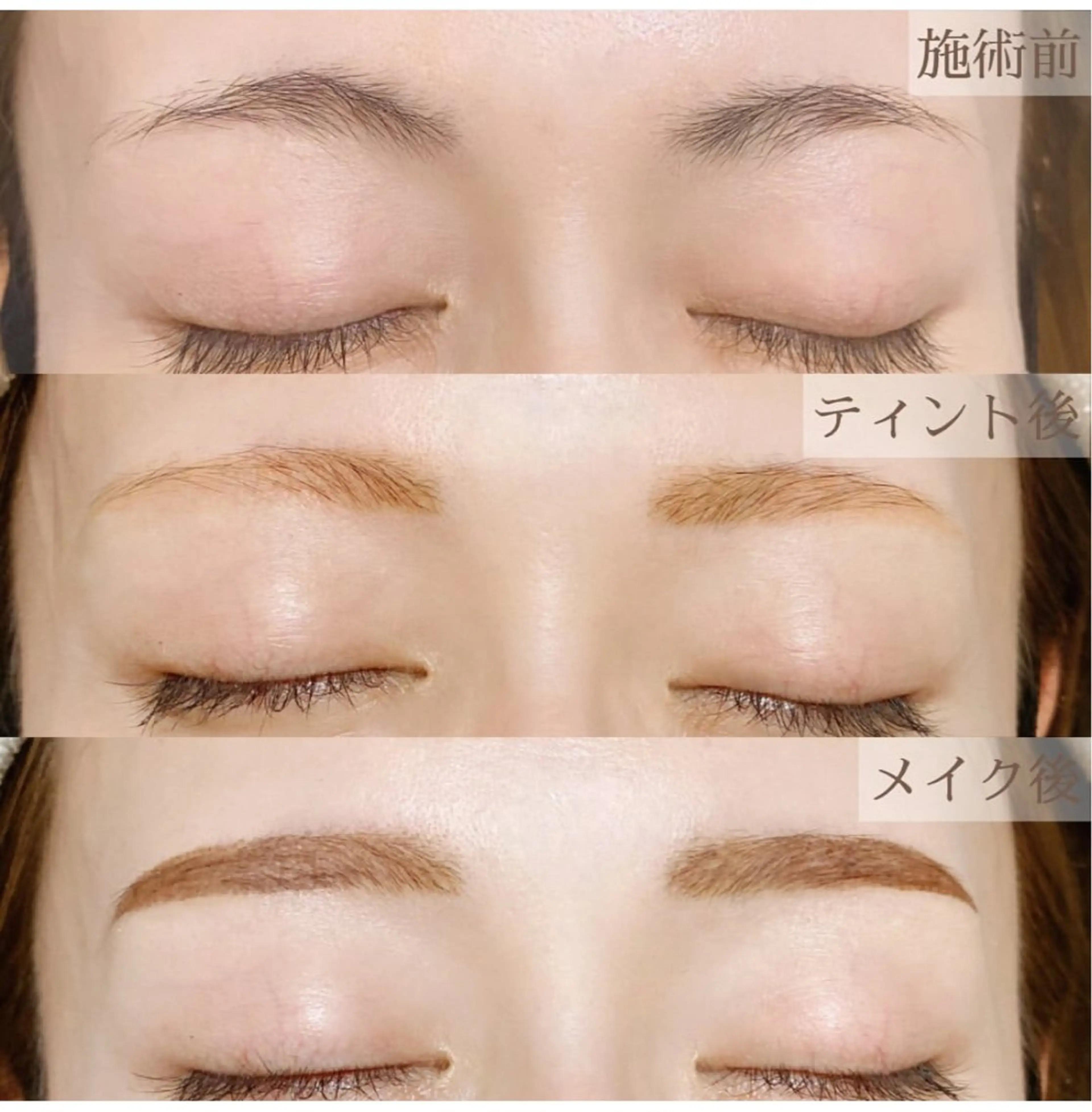 《期間限定》美眉Wax脱毛＋ティント9,180→4,400の写真