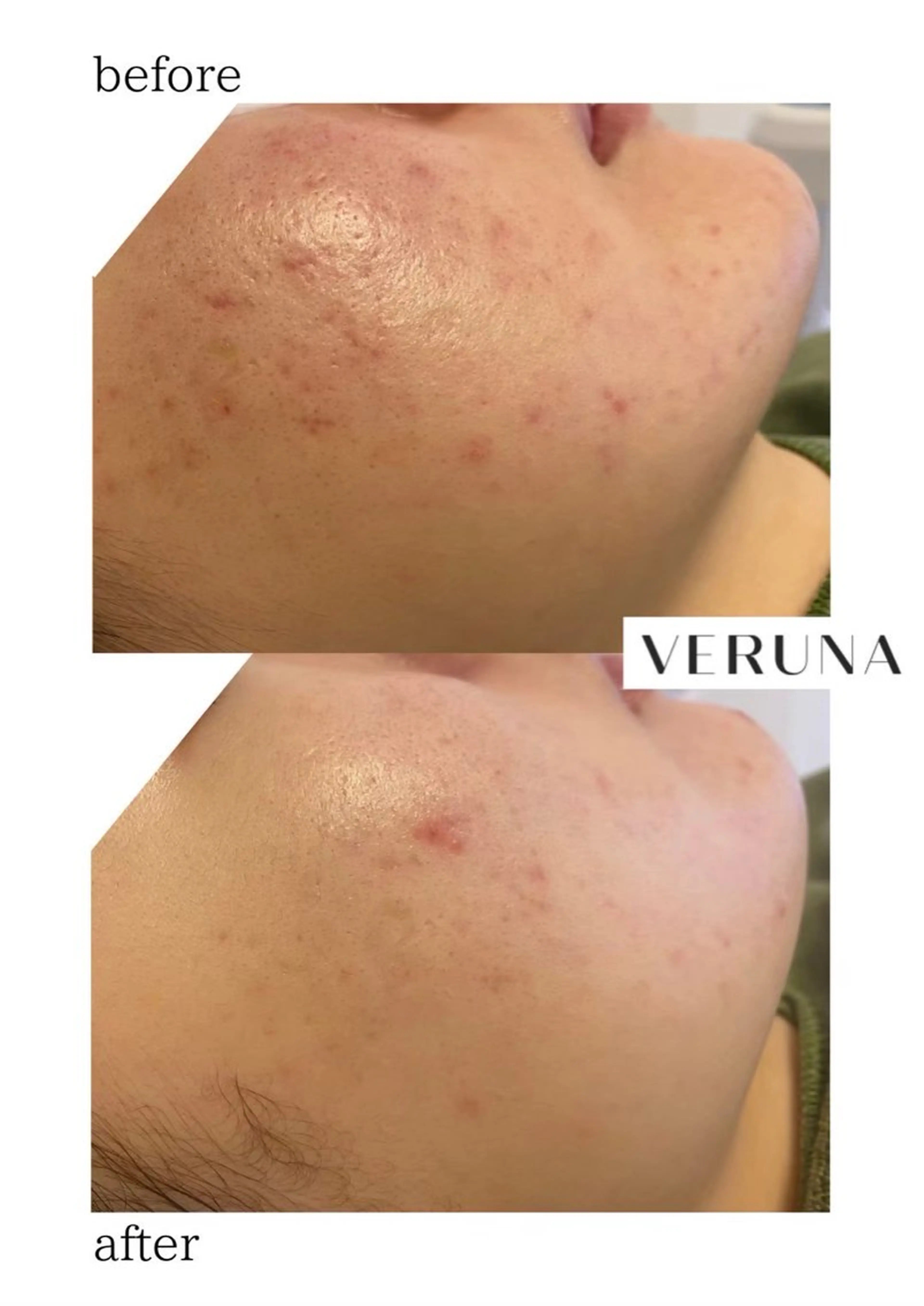 Grandir所属・ハーブピーリング専門 グランディール　武内のエステ・リラクイメージ