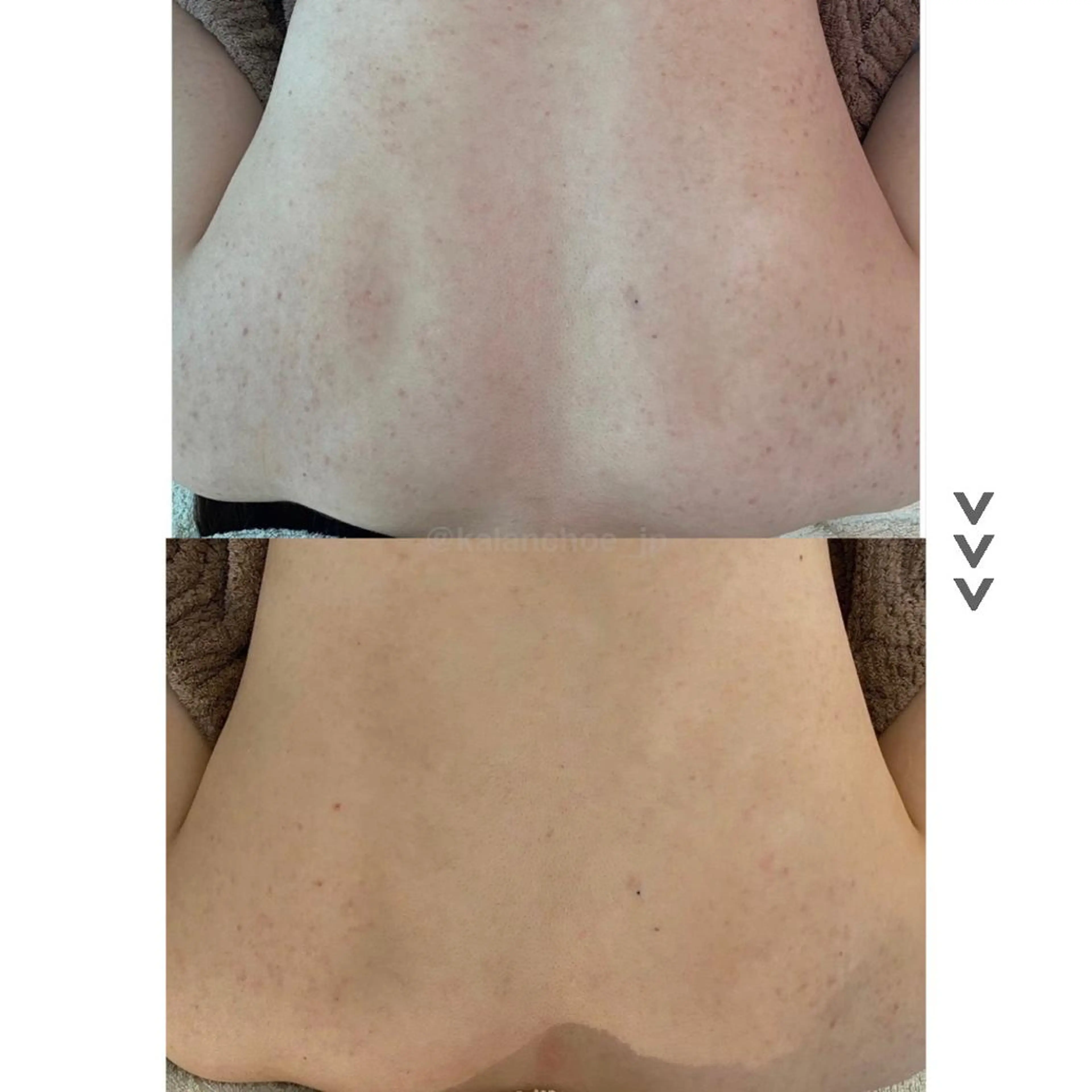 エステ リラク 肌質改善 KALANCHOEのエステ・リラクイメージ