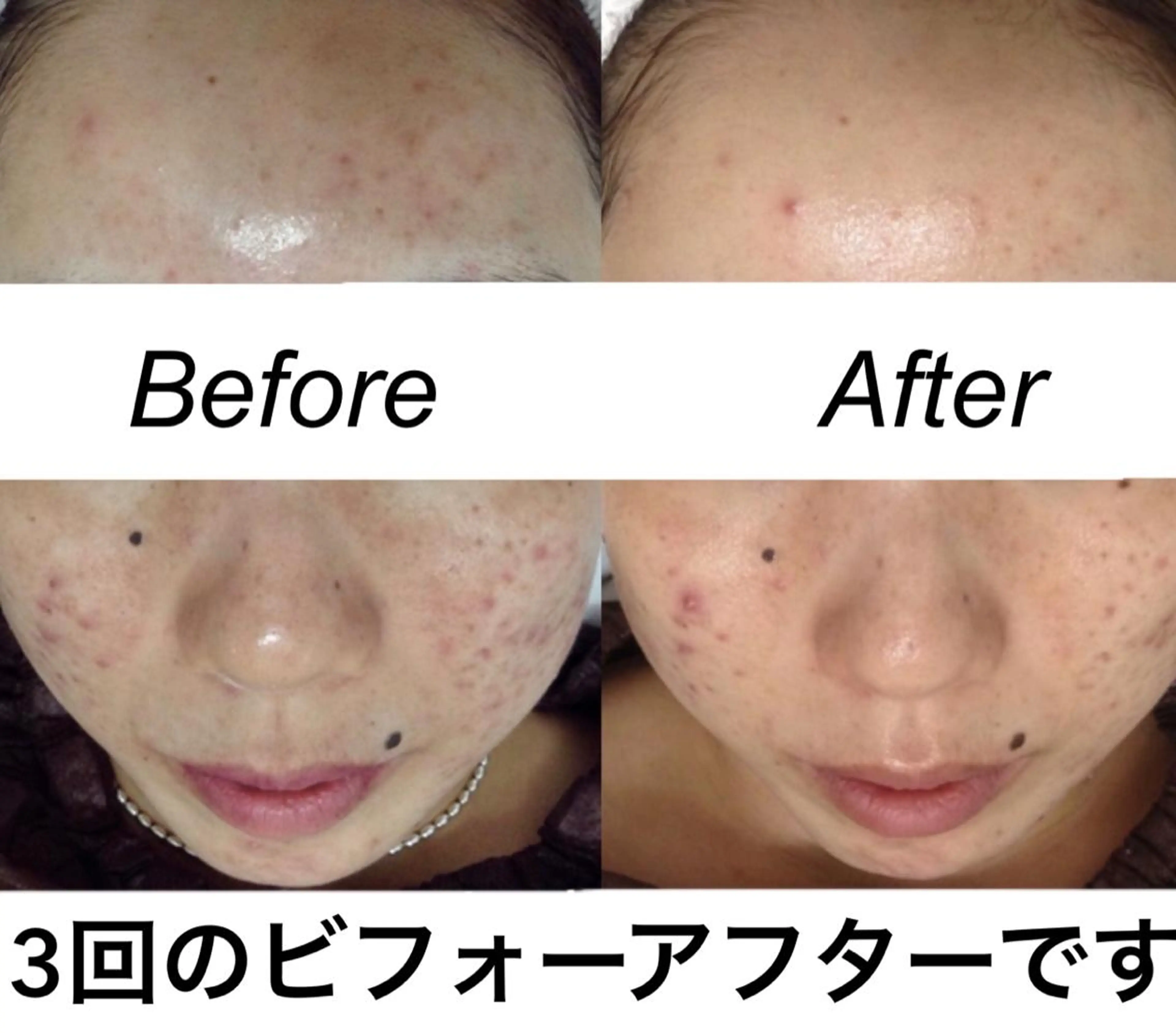 セミロング カラー パーマ ヘアアレンジ ネイル マツエク・マツパ エステ リラク 都度払い肌質改善 &脱毛Blancheのエステ・リラクイメージ