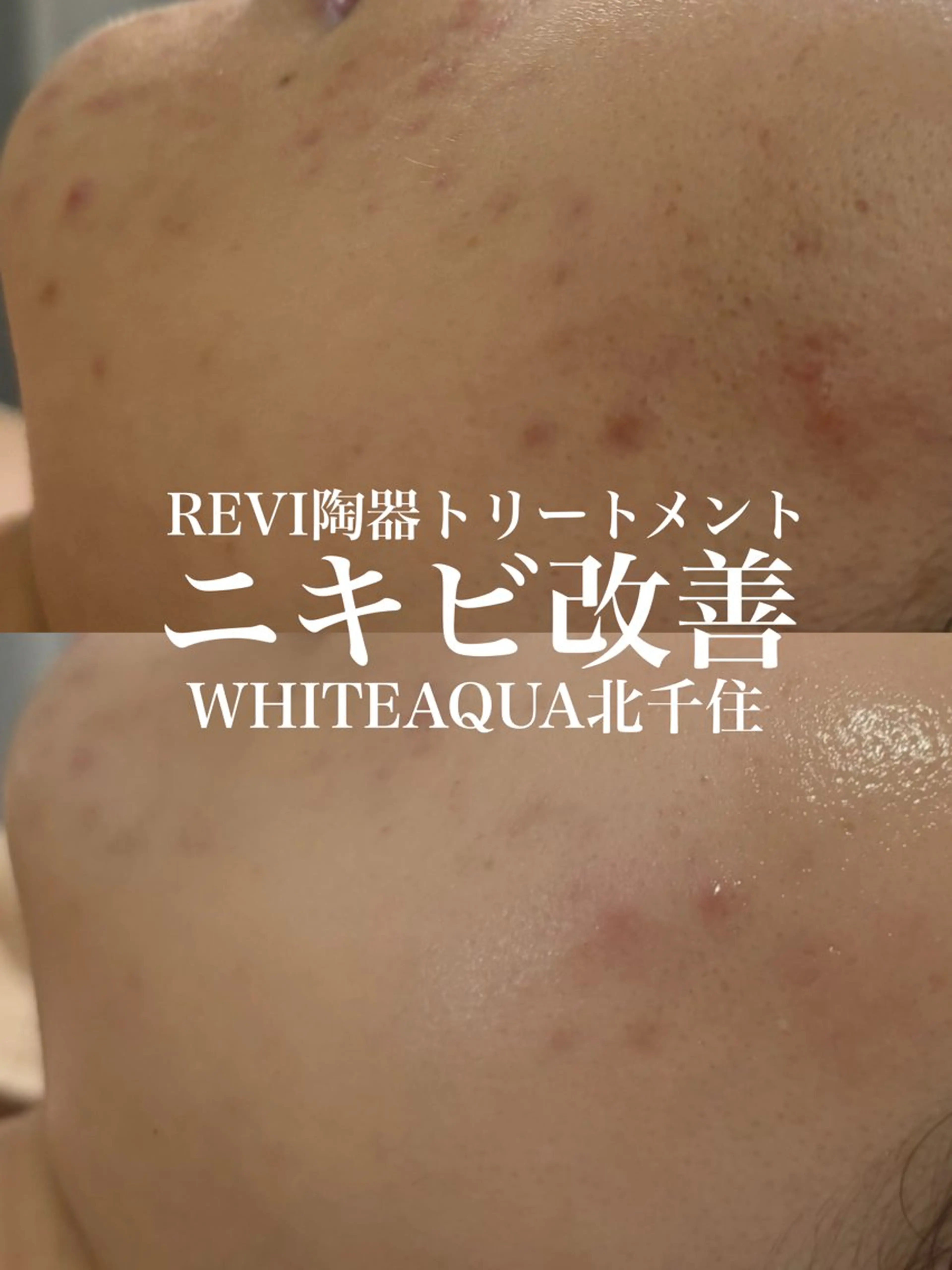エステ WHITE AQUA 北千住店のエステ・リラクイメージ