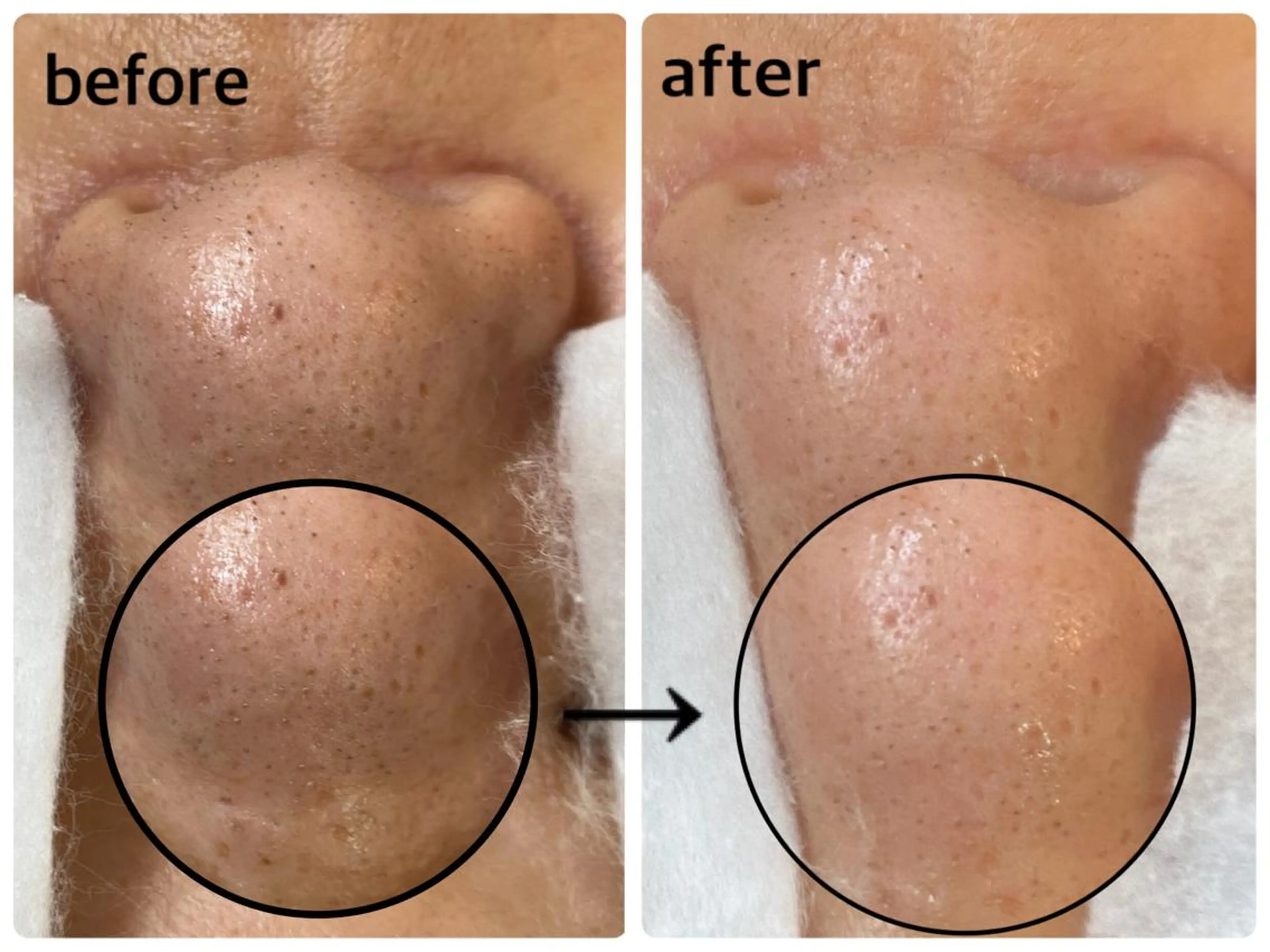 韓国肌管理 【毛穴専科】のエステ・リラクイメージ